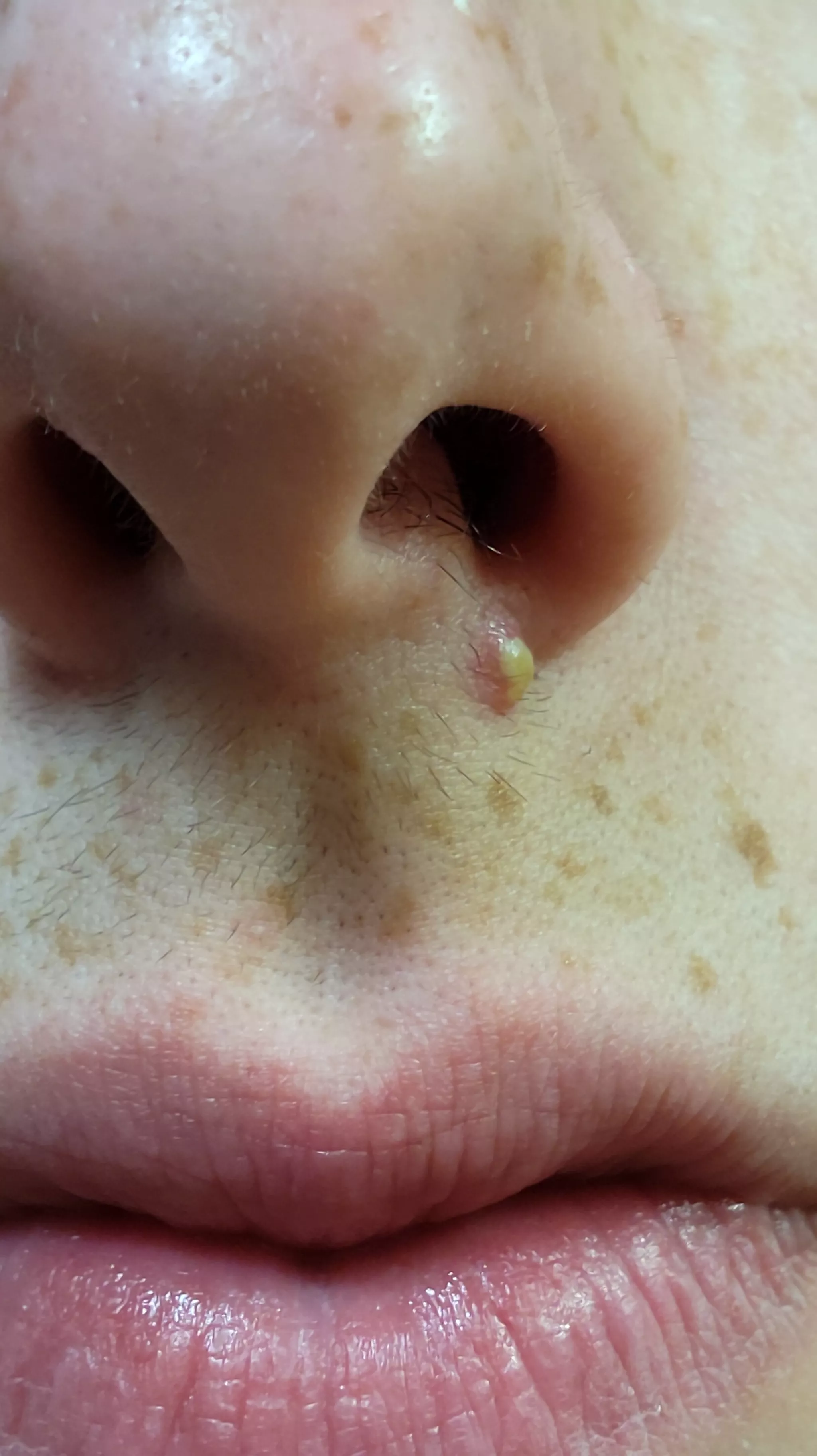 I have school and work tomorrow, would this be better or worse to pop it posted by joeyischillin