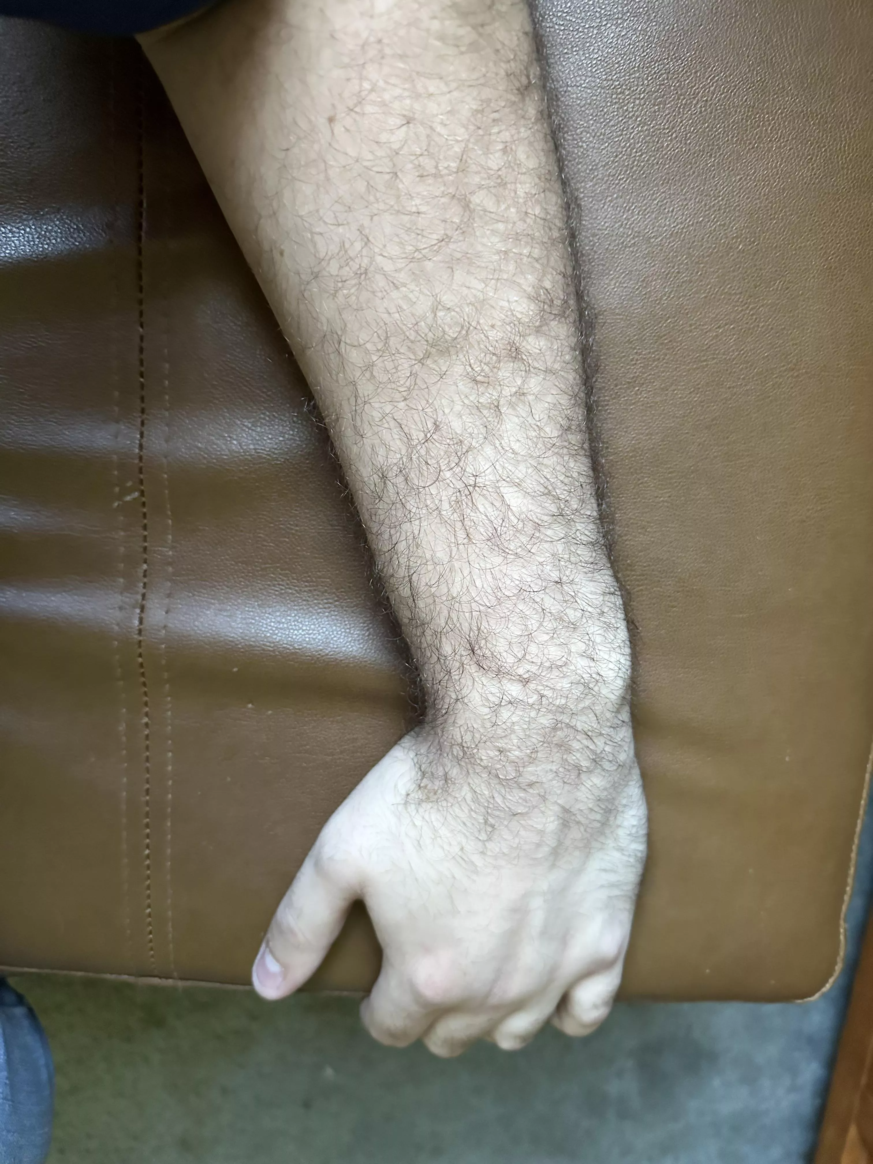 Hairy forearm posted by [deleted]