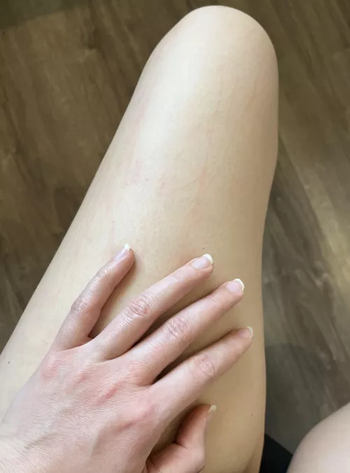 Just scratched a little too much by QueenOryxObedience