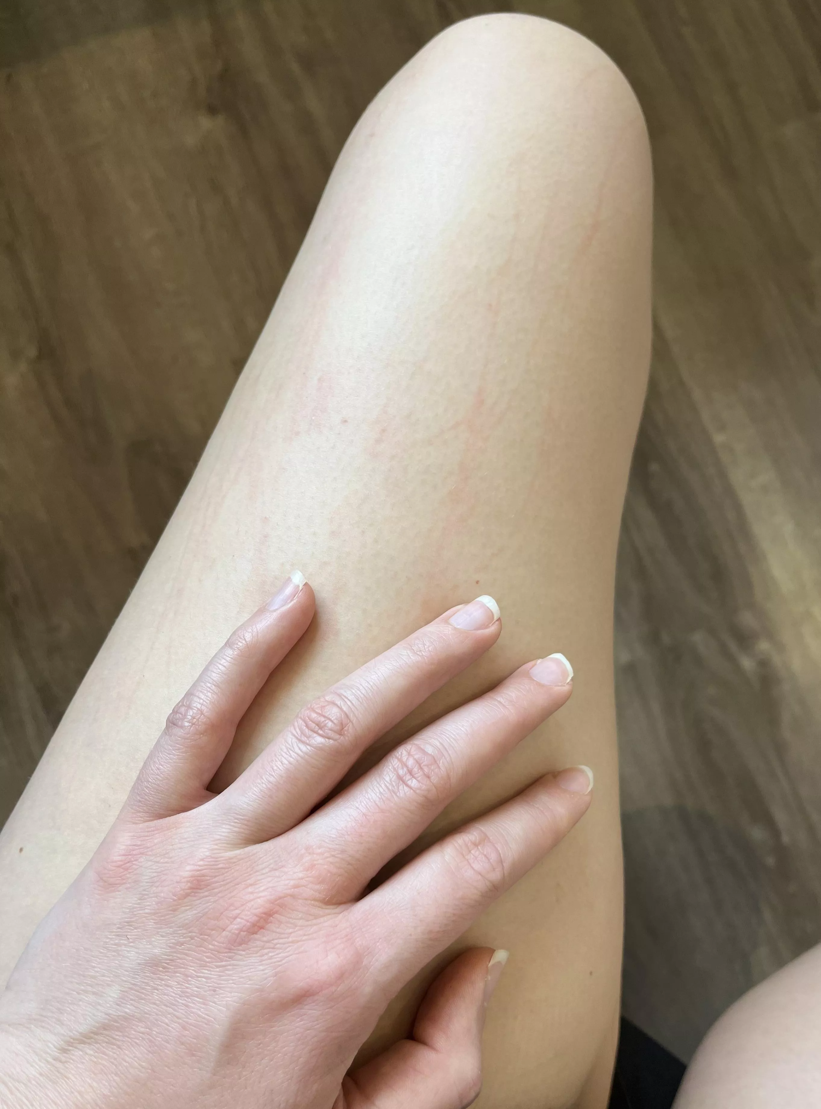 Just scratched a little too much posted by QueenOryxObedience