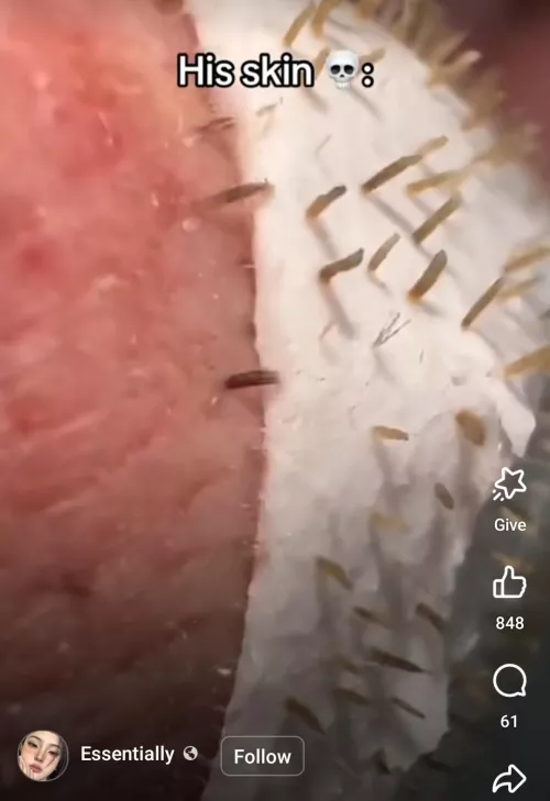Is there a blackhead remover that does this? Saw this on FB but not clicking the link. by PerformanceOk9933