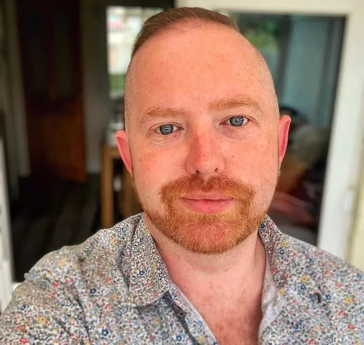 My Freckles use to be my insecurity. Now I just have to admit and own. I think it makes me cute posted by __unplug