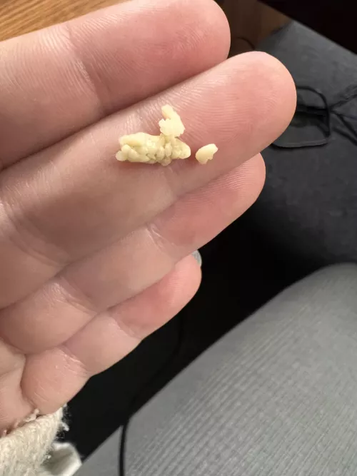 Coughed and this thing shot out! Have more in there but idk how to get them out without gagging by goddess62598