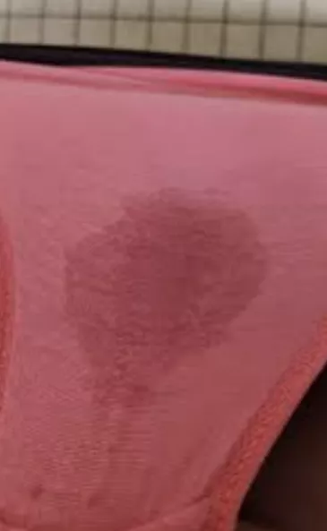 Oh my posted by Beneficial_Water1139