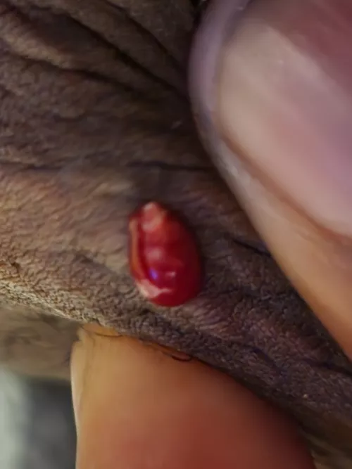 Bump on inner thigh (hurt like hell) by Honest_Willow_2597