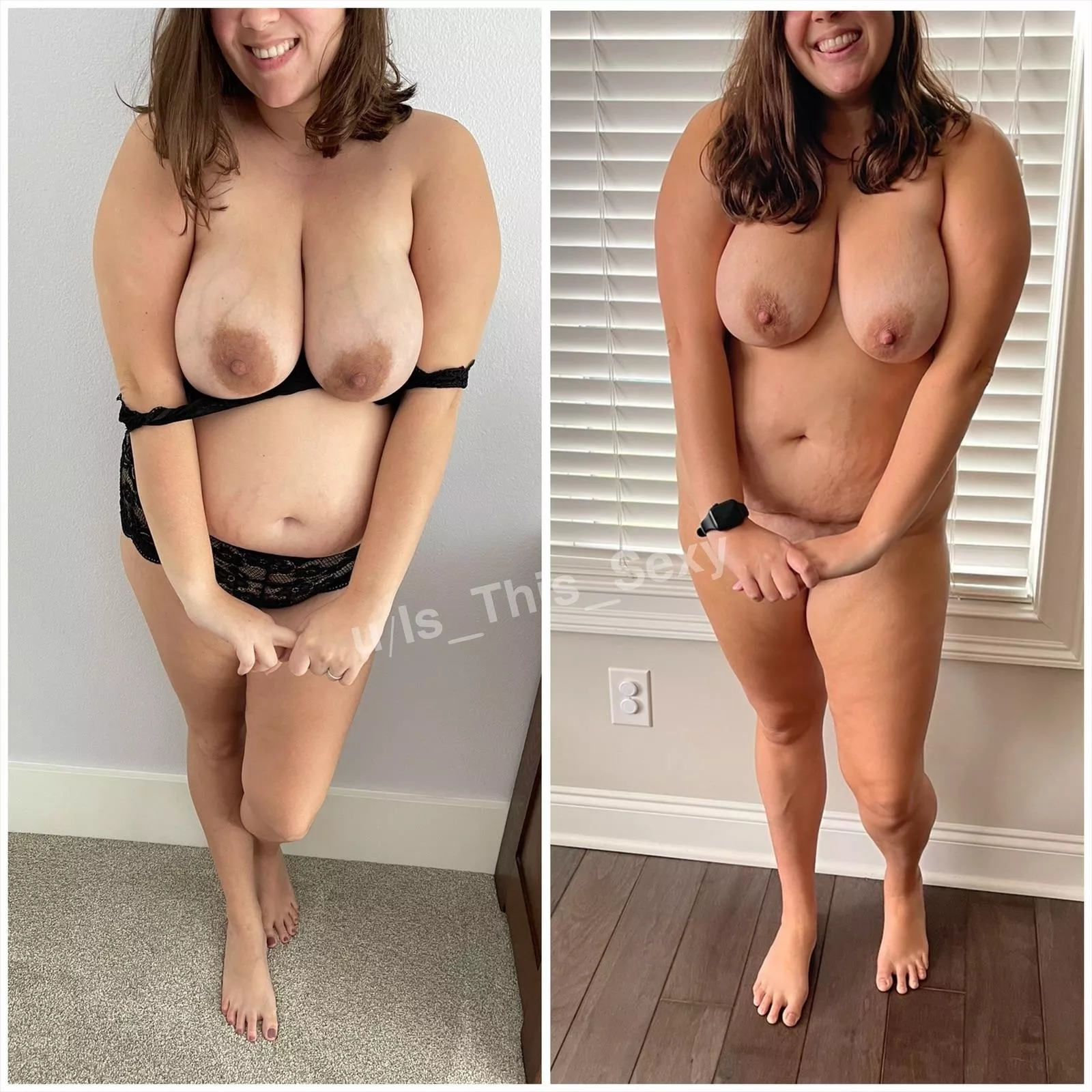 During pregnancy, vs after pregnancy. Look at the nipple change! posted by Is_This_Sexy