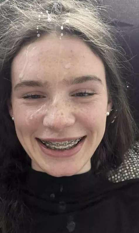 The Braces Need A Load Or Two posted by KingKaneWood