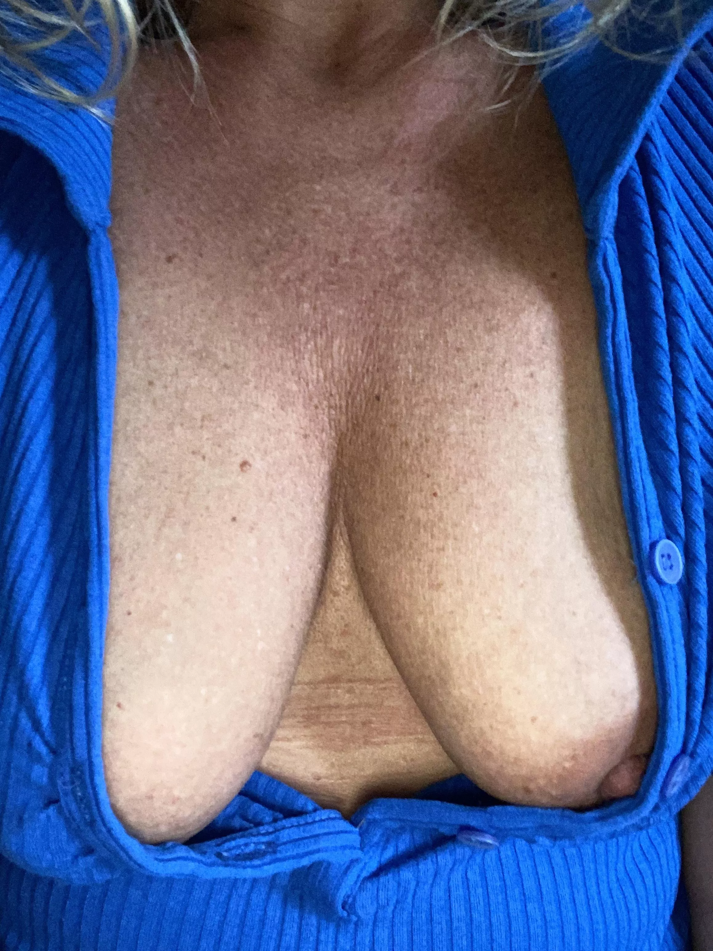 Is this to many buttons to have undone or not enough? posted by Totalnaturalblonde