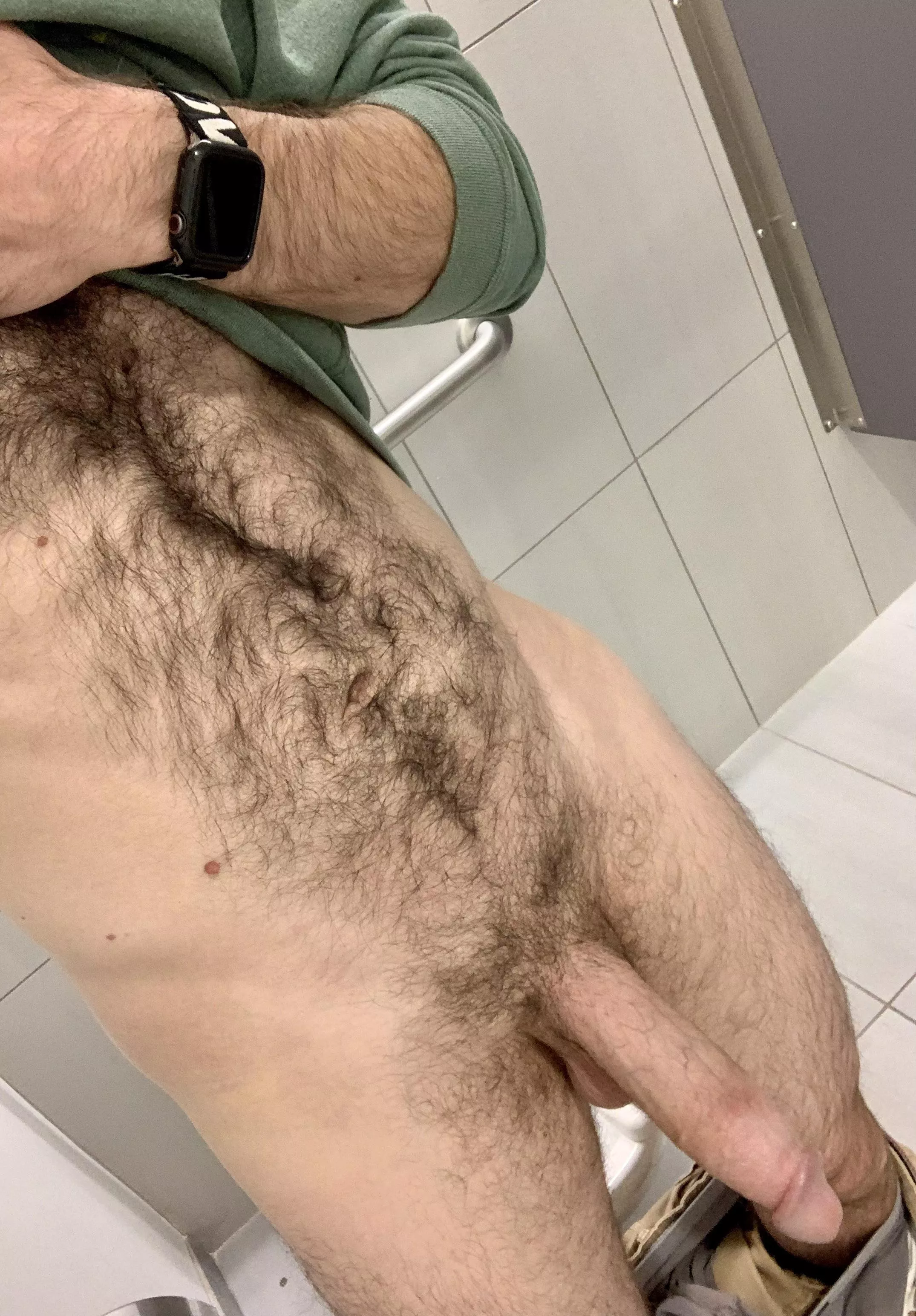 Would you consider me insanely hairy? [30] posted by Pretend_Pay_6095
