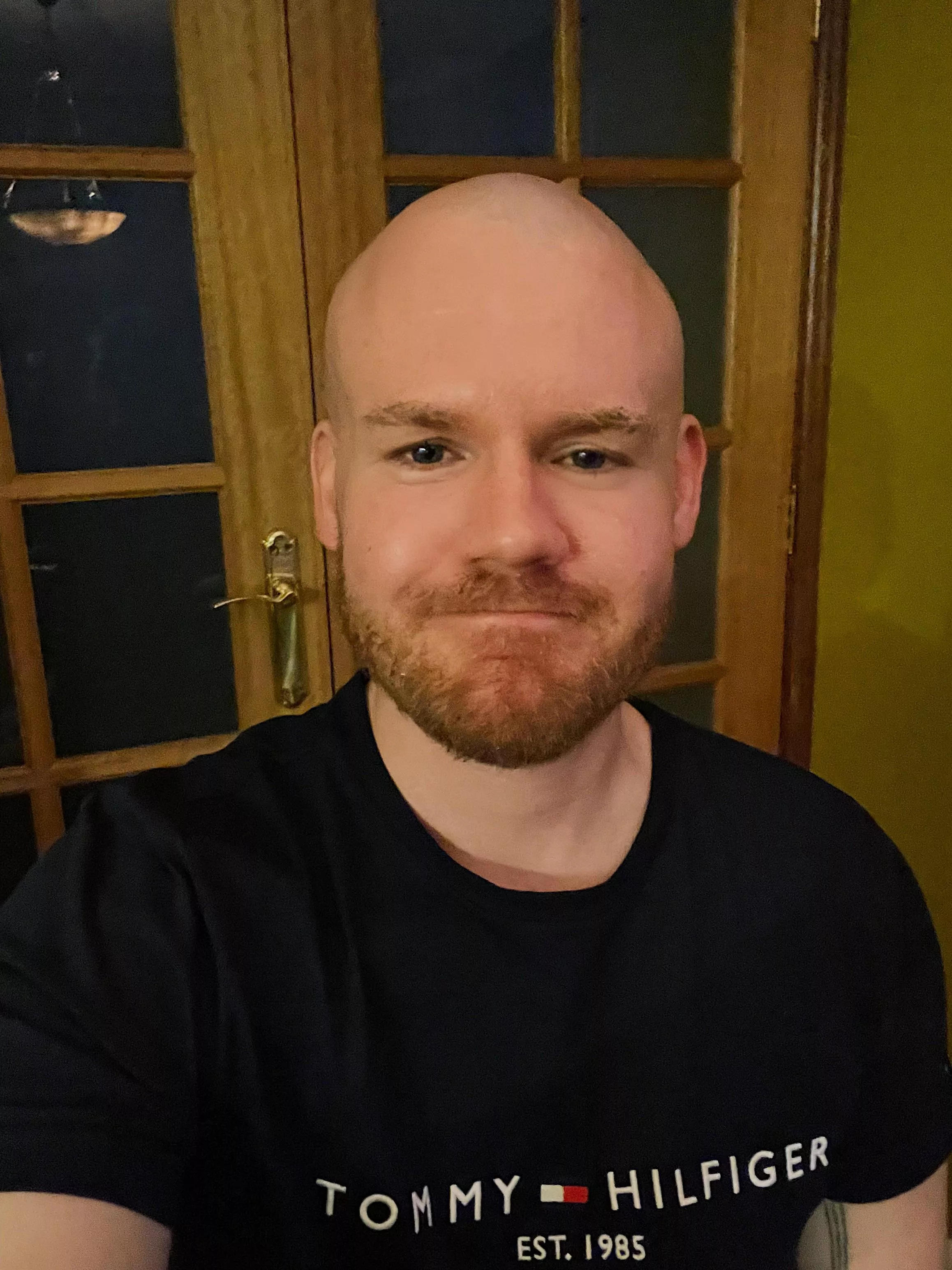 Embraced my baldness and feeling better than I anticipated posted by FaithlessnessOne5129