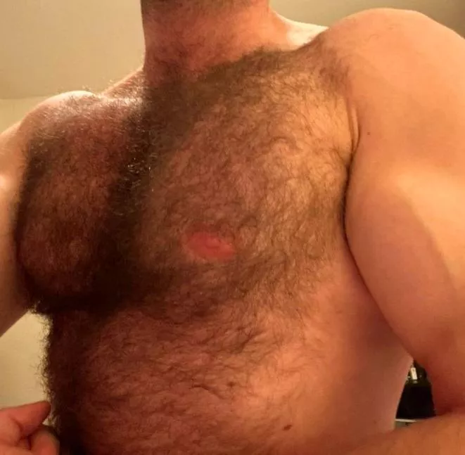 Rednip posted by acersacharrum97