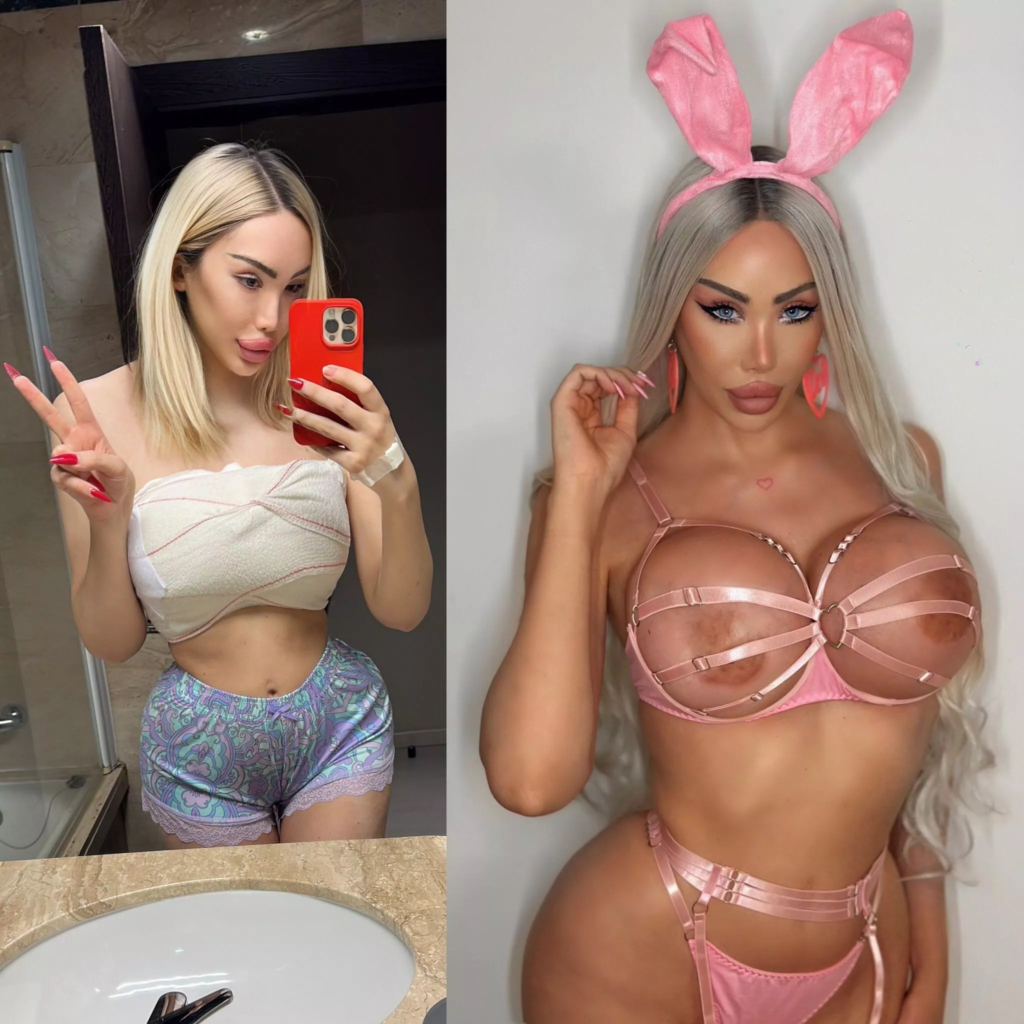 My before and after this year posted by Luxury_Plastic_Doll