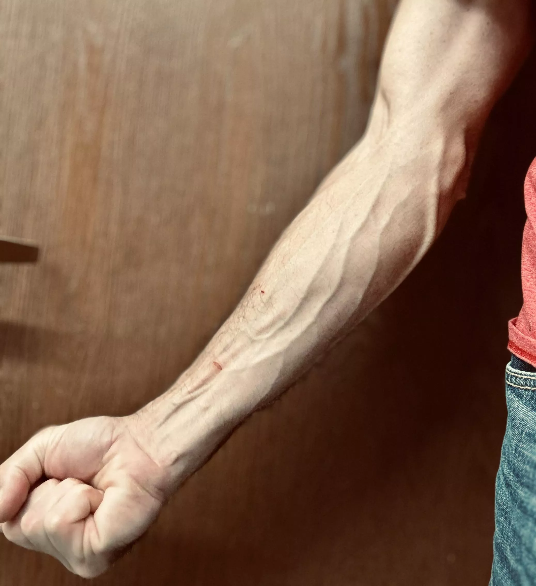 A few cuts and scratches just show that you worked today posted by Shamwowforyou