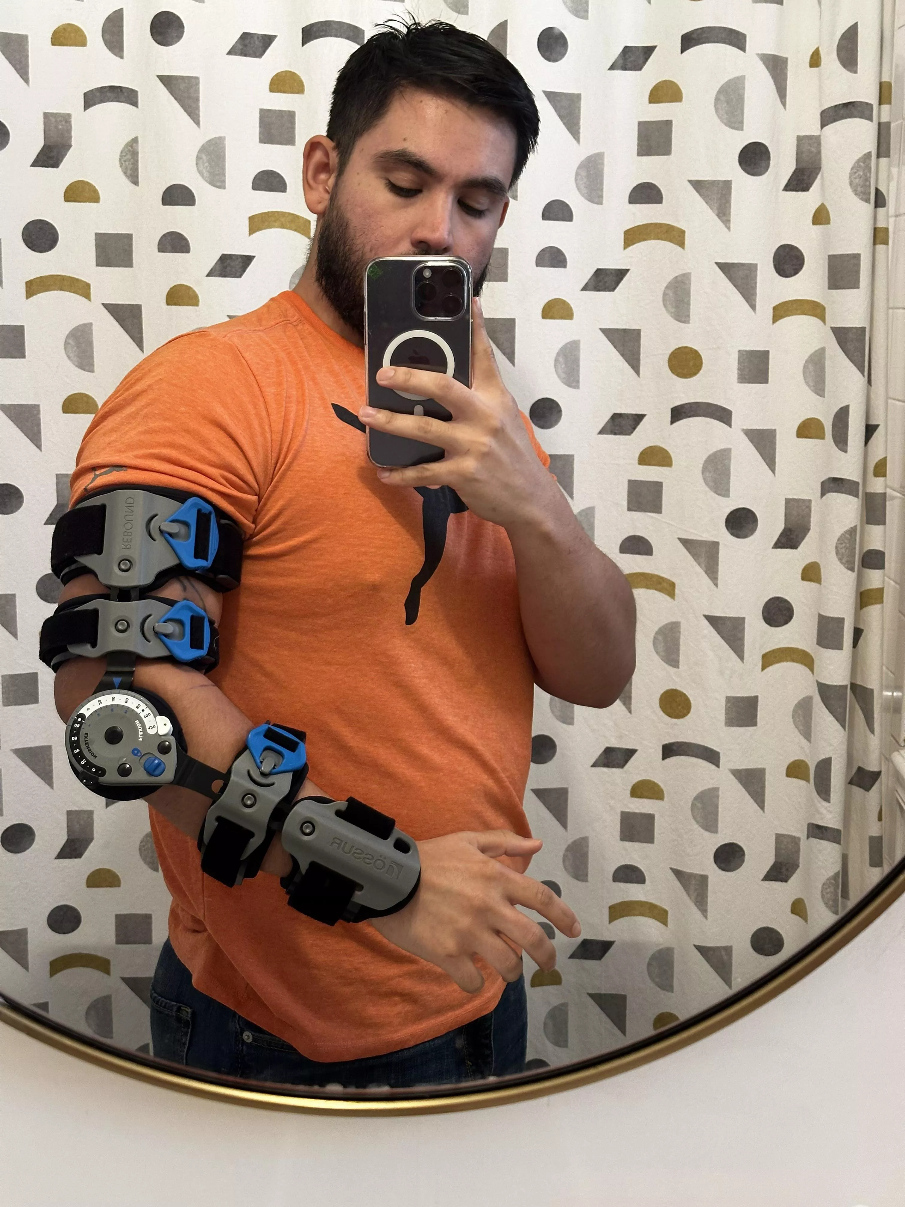 I tore my distal bicep tendon and I got surgery two weeks ago to repair it. posted by Emiltonic