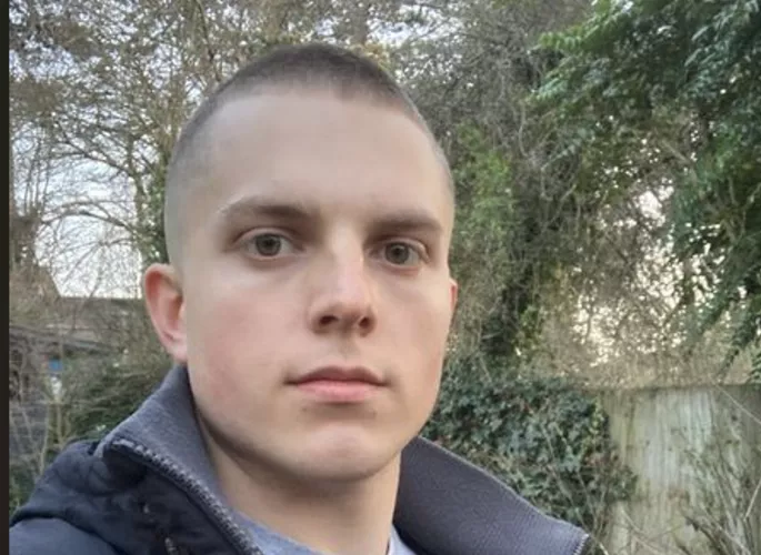 Hi guys! Really appreciate your perspective on that previous post! I once had my lips pierced like an idiot, but then had them removed, which has forever meant I am left with these ugly 'white' marks. I think they look weird AF. What that would be your by Ok_Contact_3745