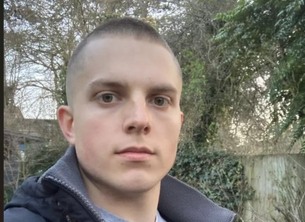 Hi guys! Really appreciate your perspective on that previous post! I once had my lips pierced like an idiot, but then had them removed, which has forever meant I am left with these ugly 'white' marks. I think they look weird AF. What that would be your posted by Ok_Contact_3745