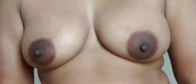 setting them freeee posted by fun_das123