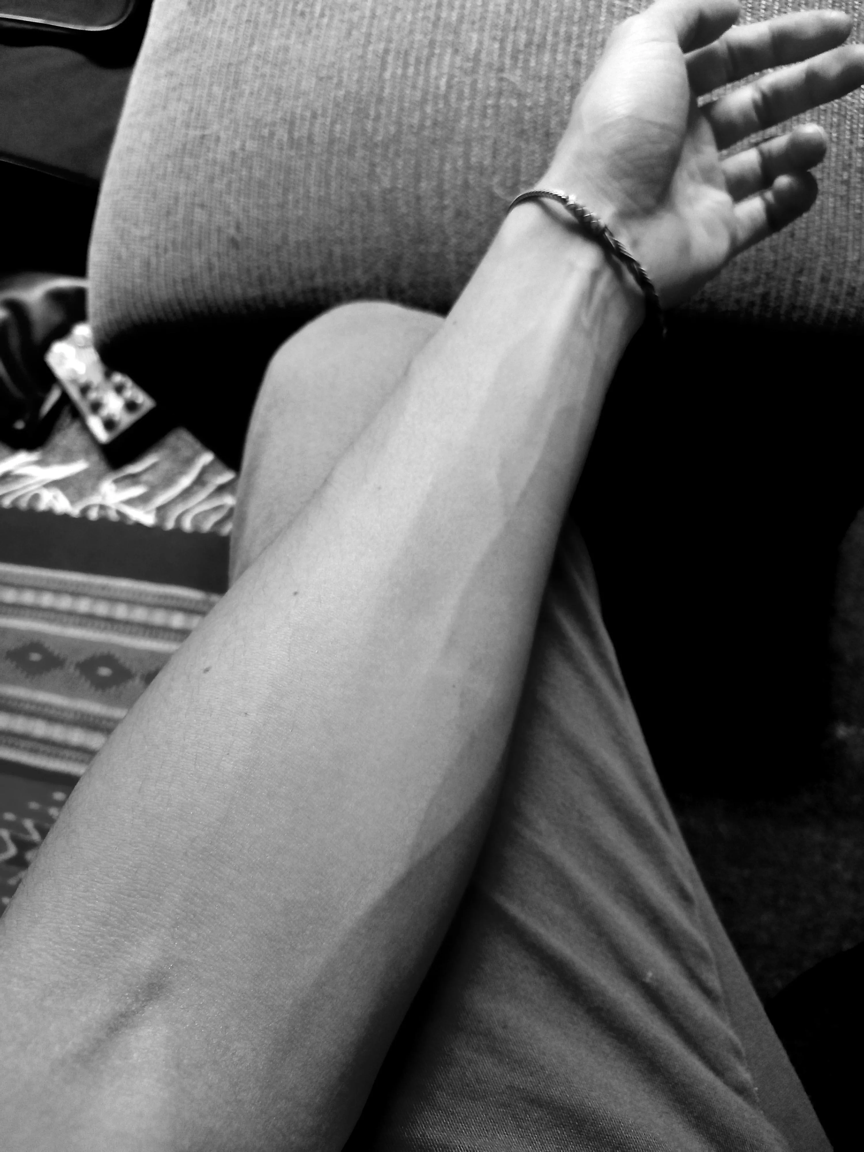 I know they aren't bulky but how about some skinny veiny arms? posted by MightyMountainRabbit