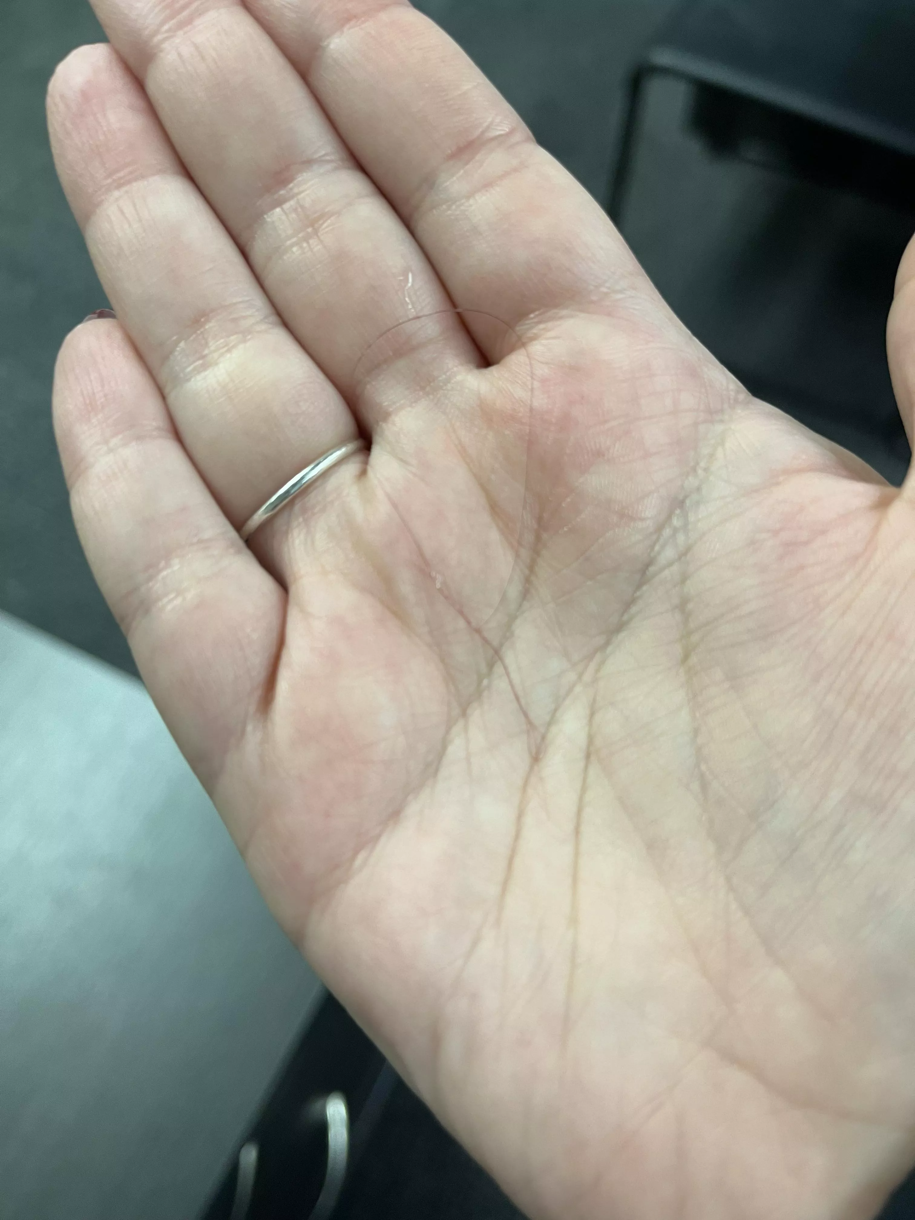 I pulled this from my left eye this morning and knew y’all would understand what I meant when I say the relief I felt was insane. posted by KaylaRocksss