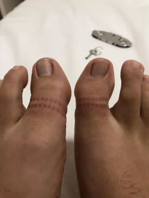 Finally I was allowed to unlock the thumbcuffs by ignaciofedzc