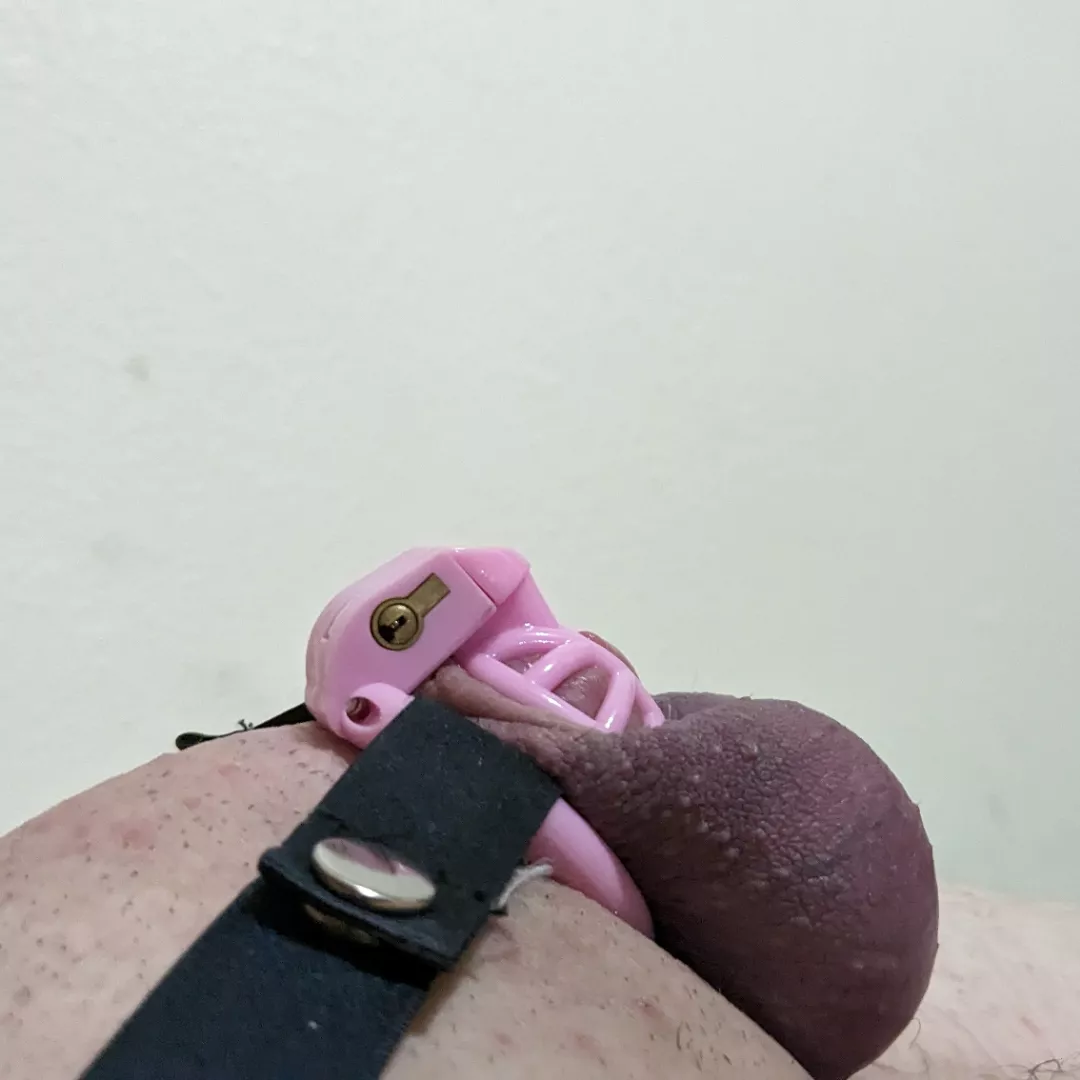 is this amount of discoloration bad? there wasn't any pain, but it felt very tight and there was a dull ache. this is is the only ring I have that stops the cage from sliding up the shaft. posted by howard0987