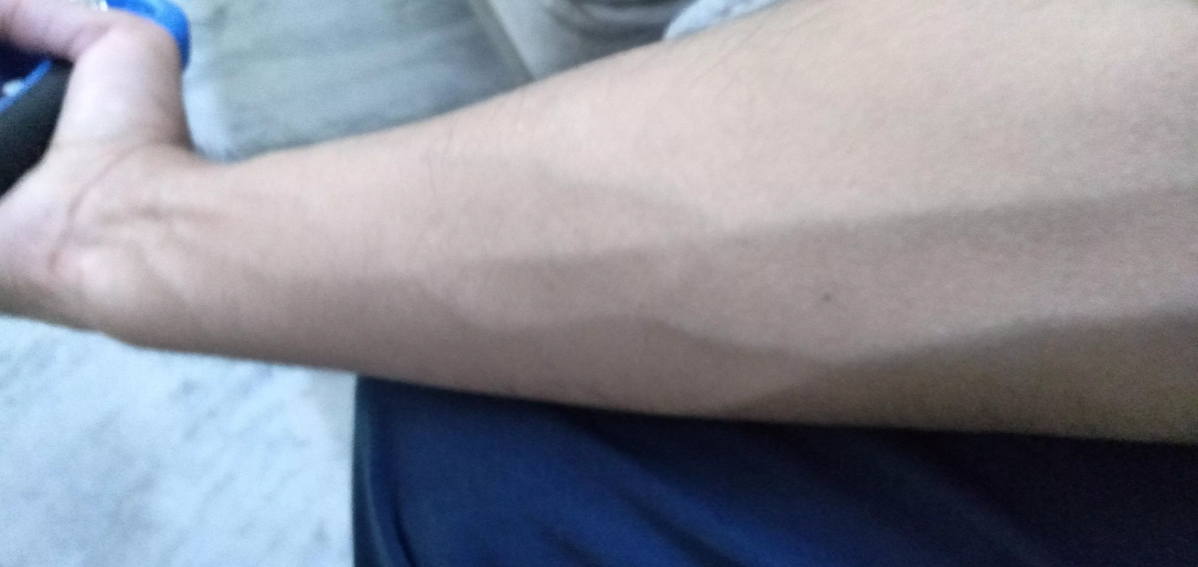 Forearms posted by No_Bluebird_9032