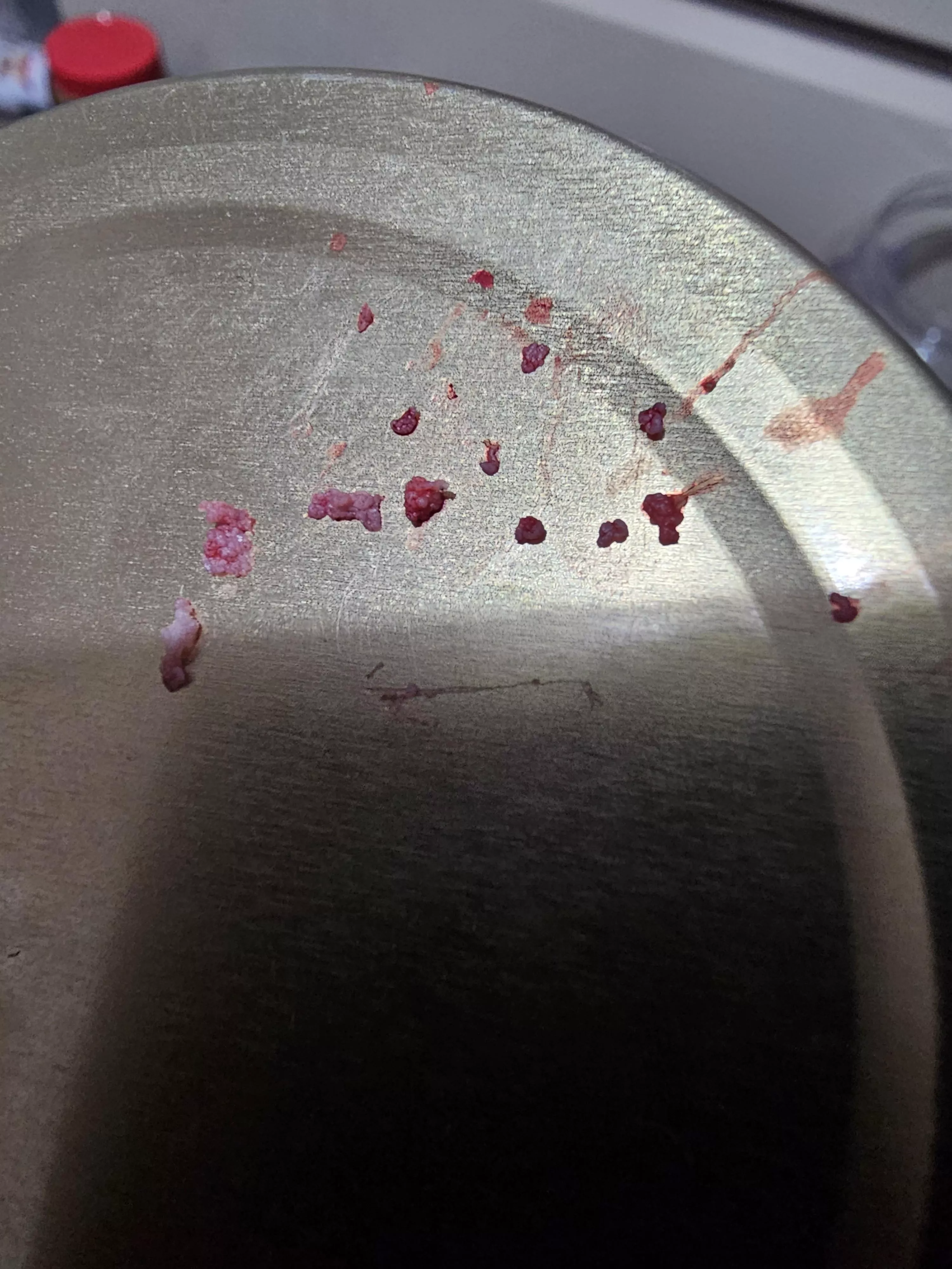 Aftermath of a pimple posted by OddOctopoda