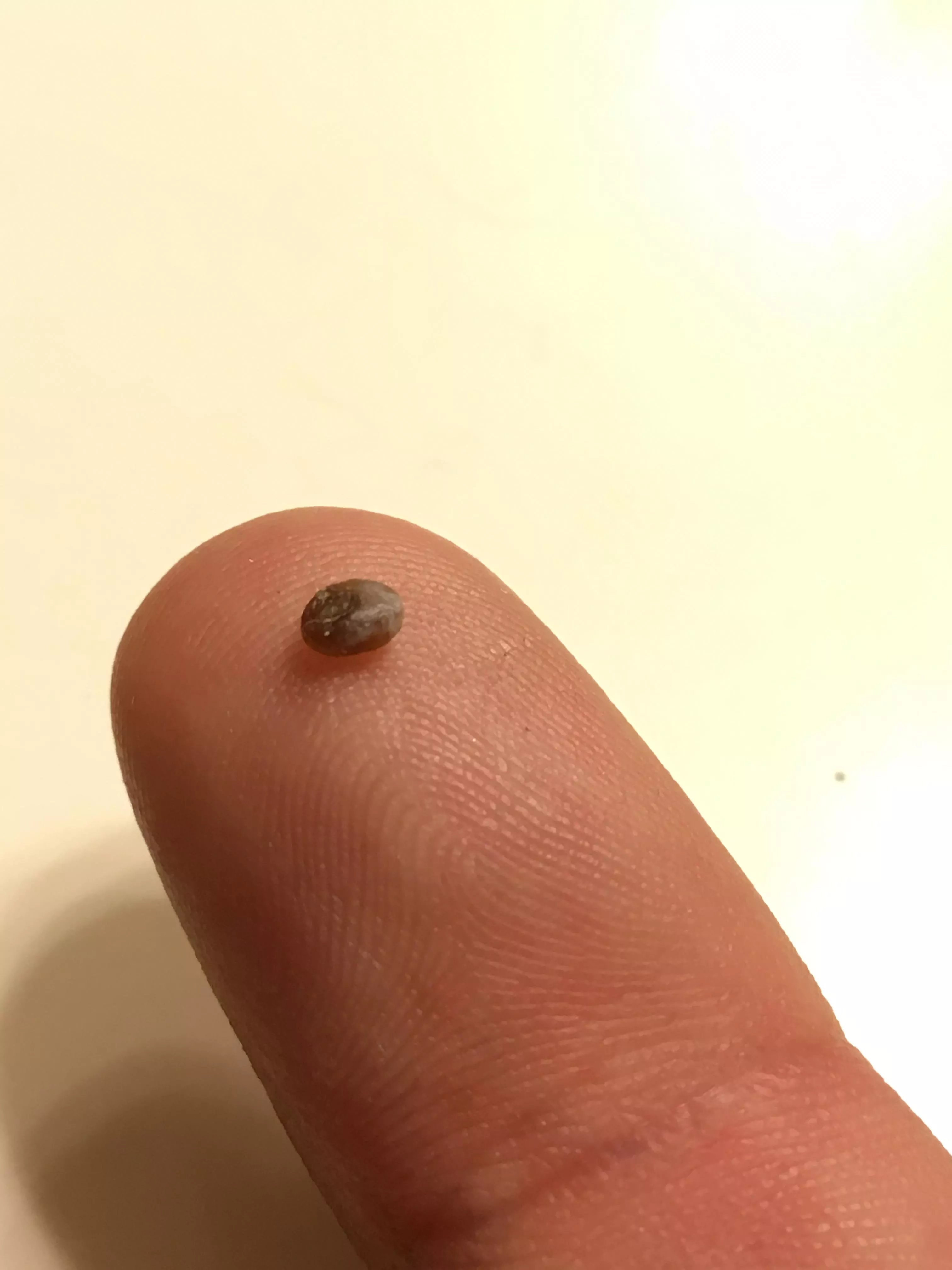 What came out of my skin? posted by Epicdudster