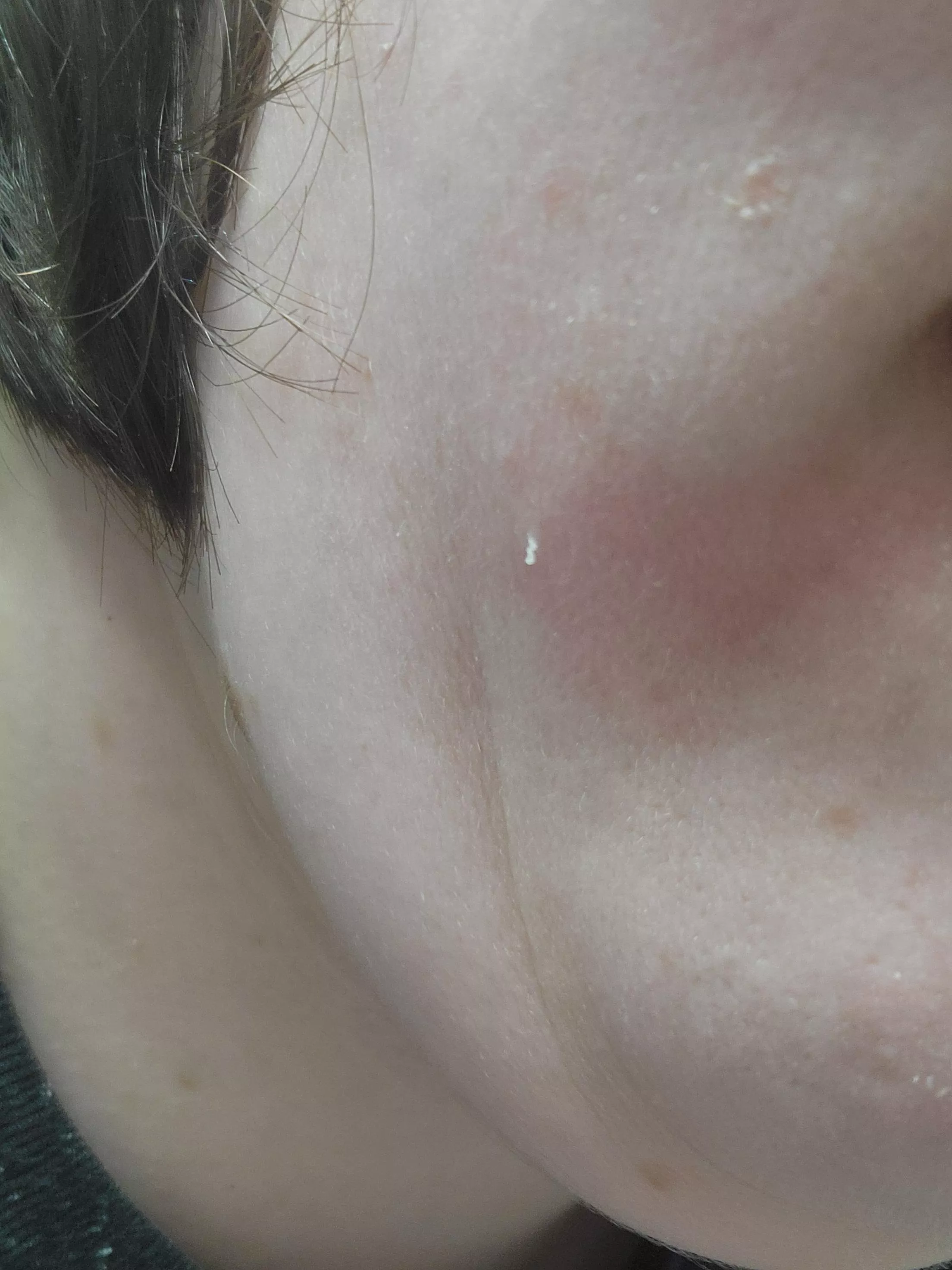 Itty bitty blackhead posted by Helpful-Sky4443