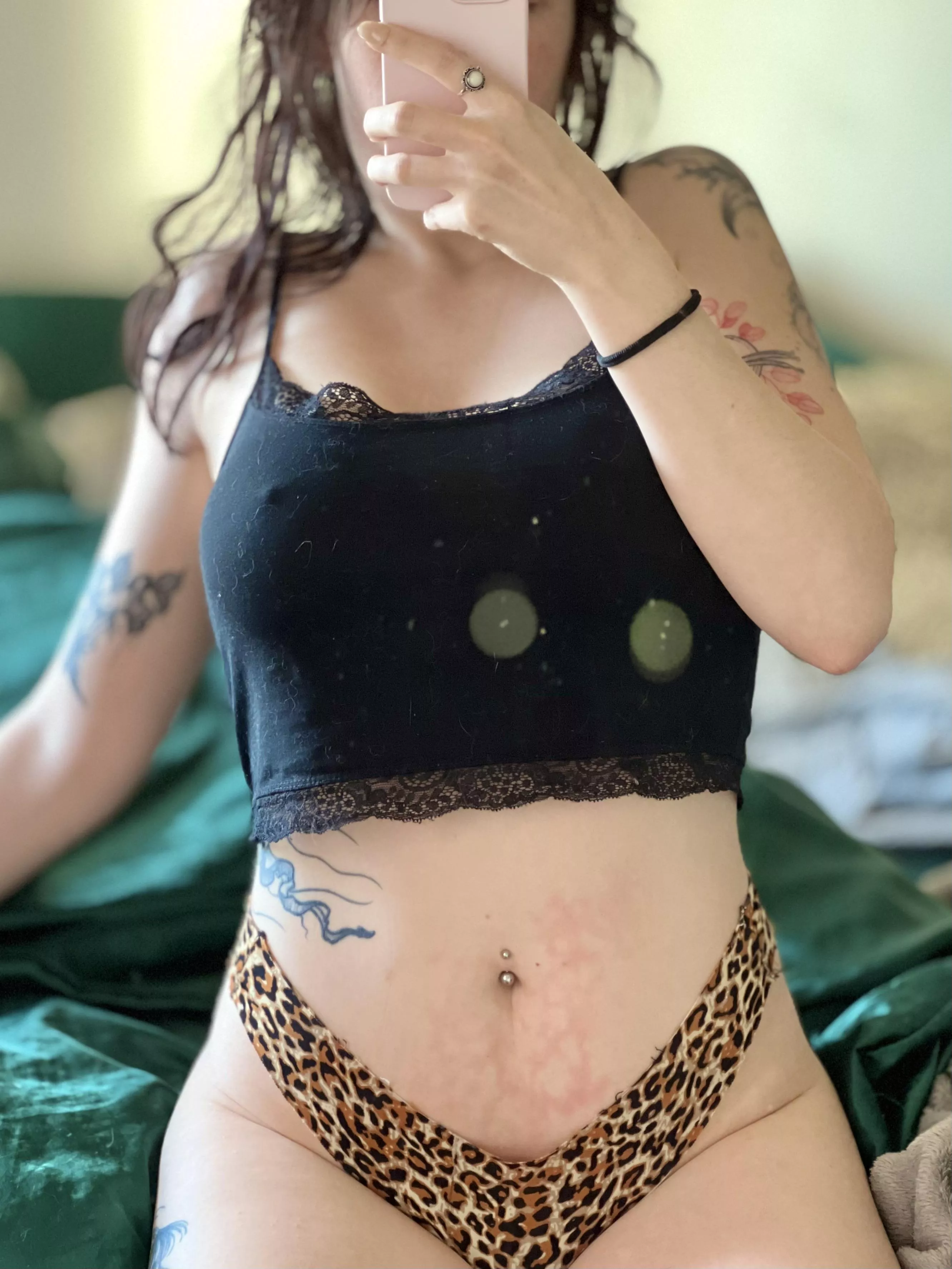 Woke up with an interesting water bottle burn mark [f] posted by CandideCrush