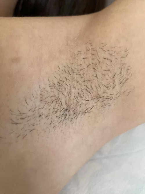 My closeup stubble pit by cuttie_kitty