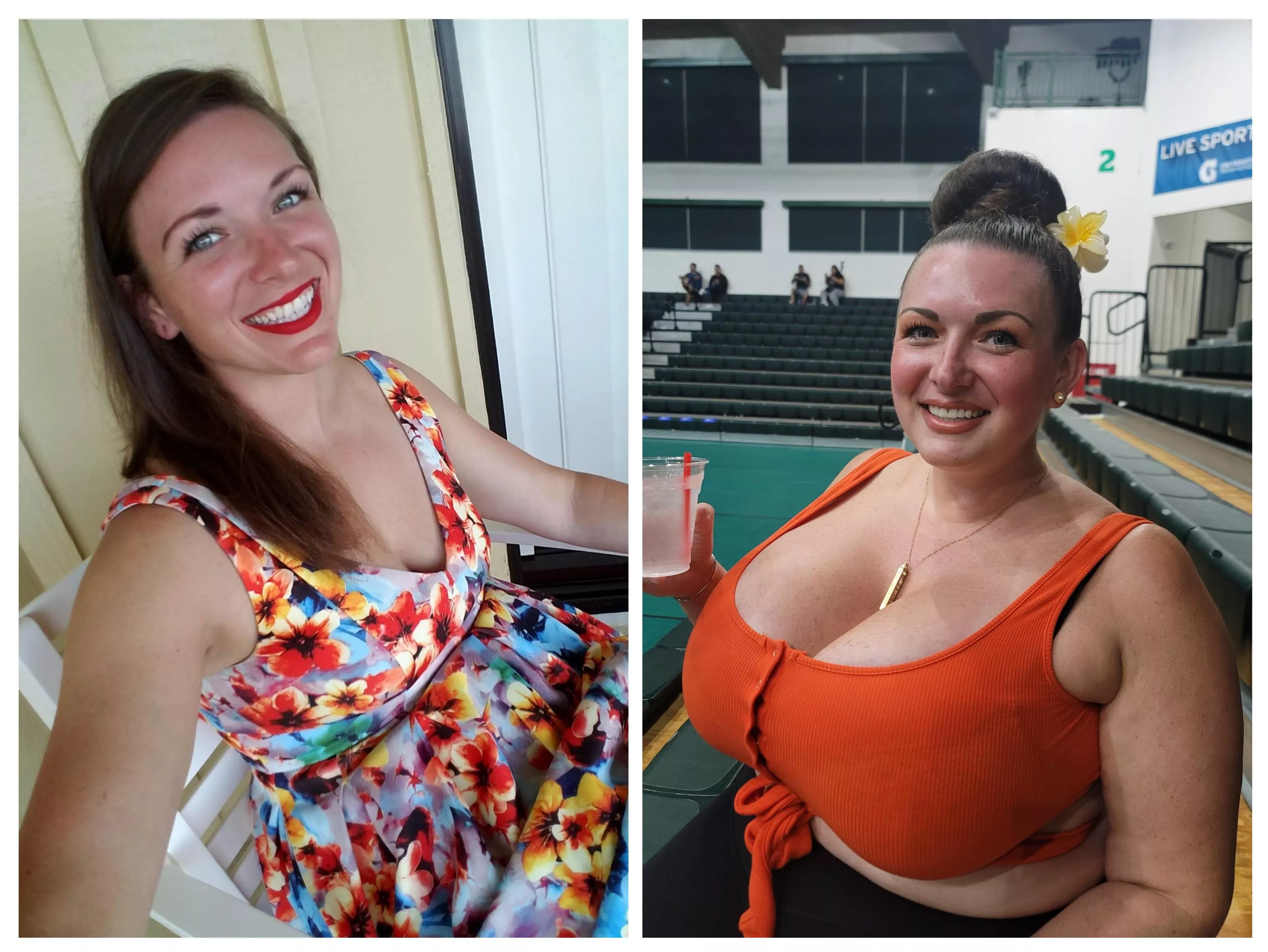 Such a big difference. Going bigger in 39 days. posted by avalonxoxo_2k