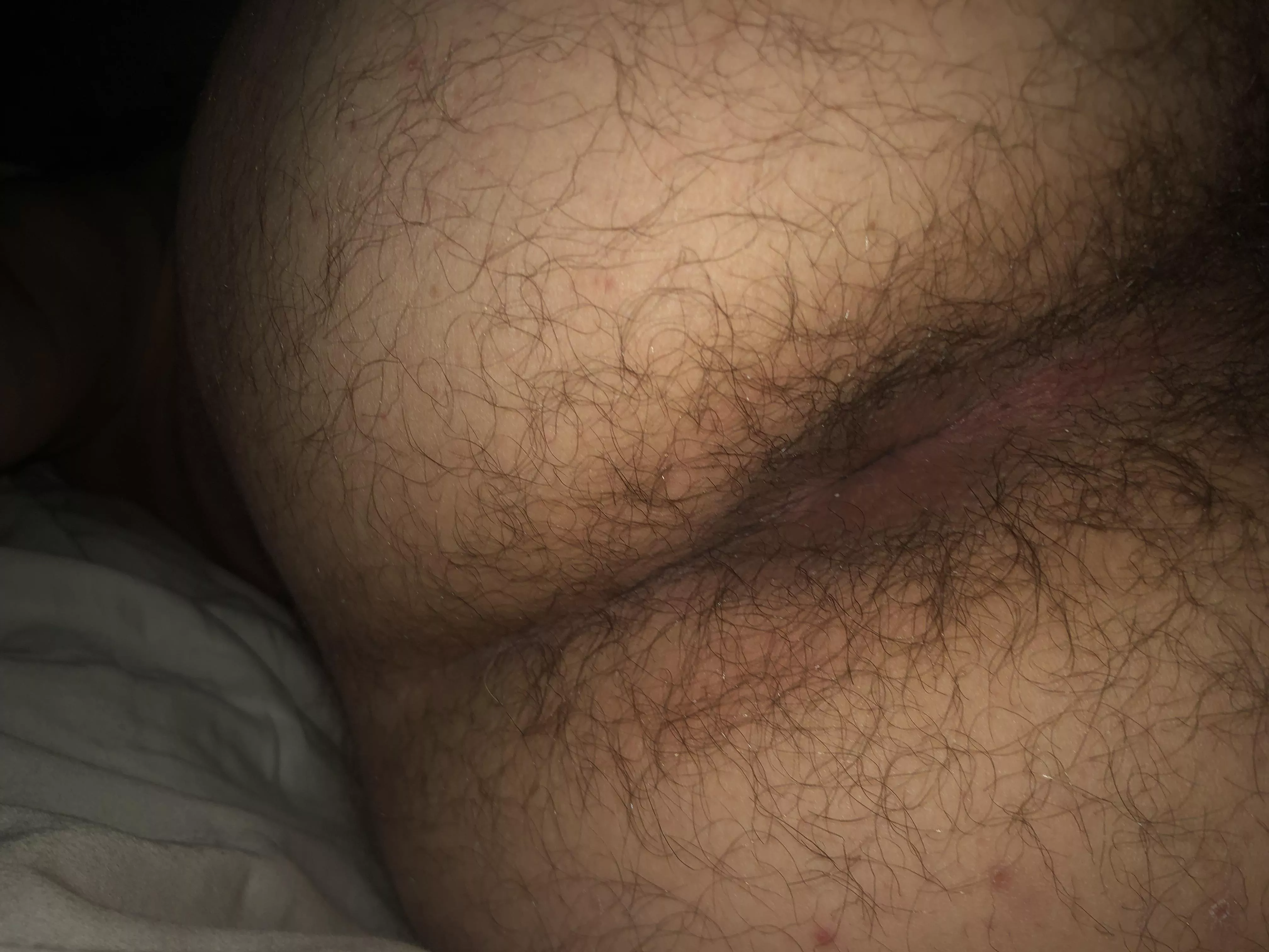 M 19. Hows my hairy hole? posted by Individual-Plenty910