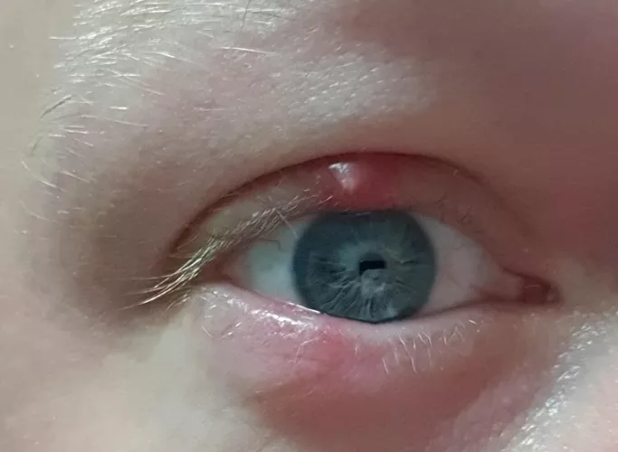 Another forbidden pop by moribound88