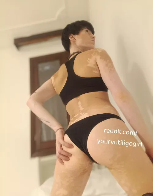 Feeling horny 🔥 by yourvitiligogirl