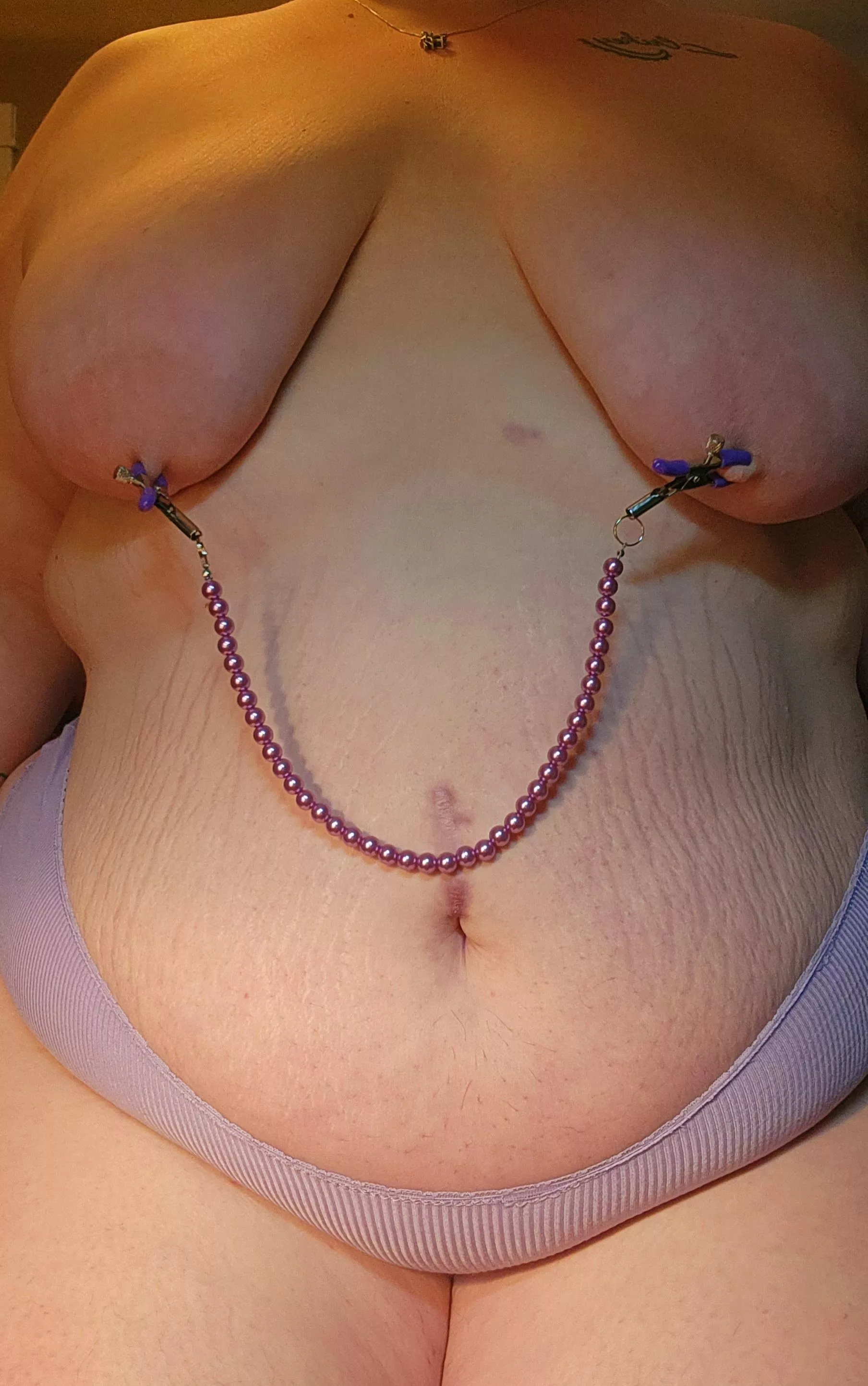 I think my stretch marks are cute. posted by wearyourscars