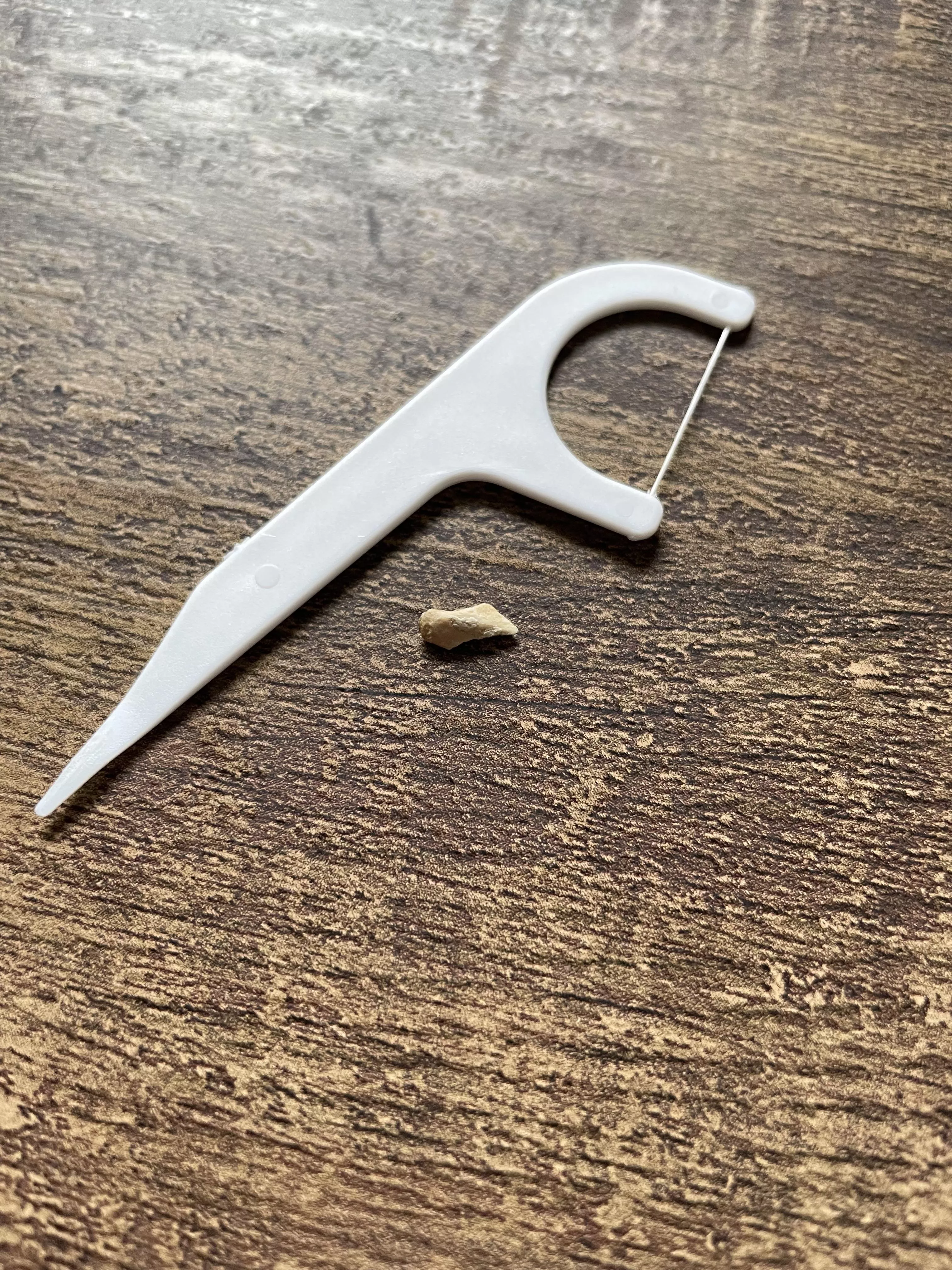 Removed this calcium buildup from behind a bottom, front tooth. posted by DaftFunk11