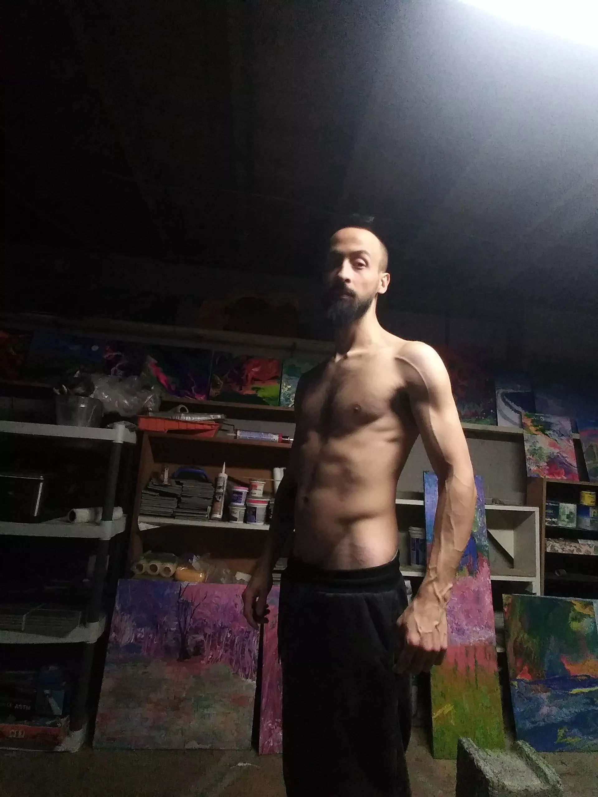 VascularAF posted by MicahBones