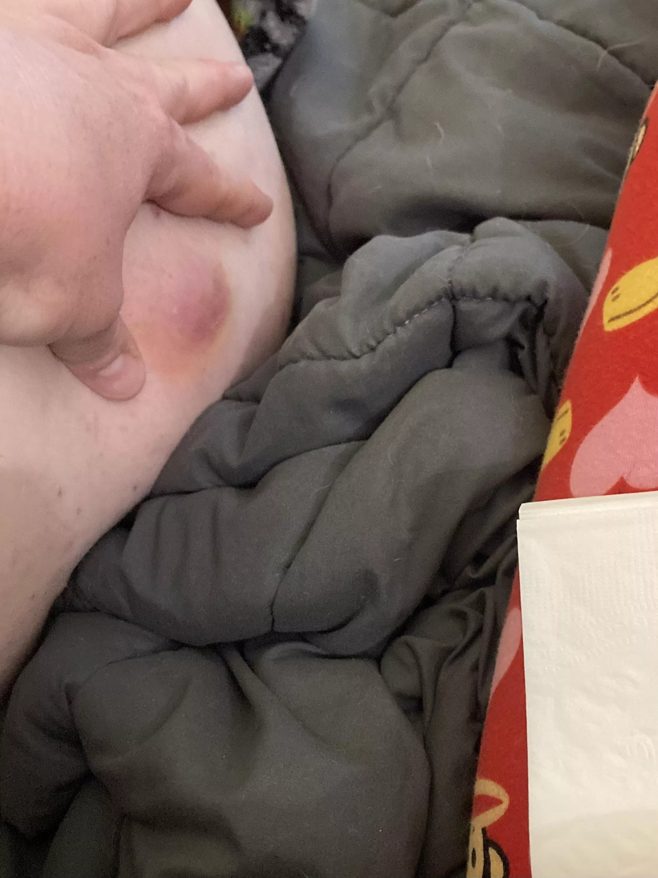 A bump on my hubs behind OC posted by False_Ad_4117