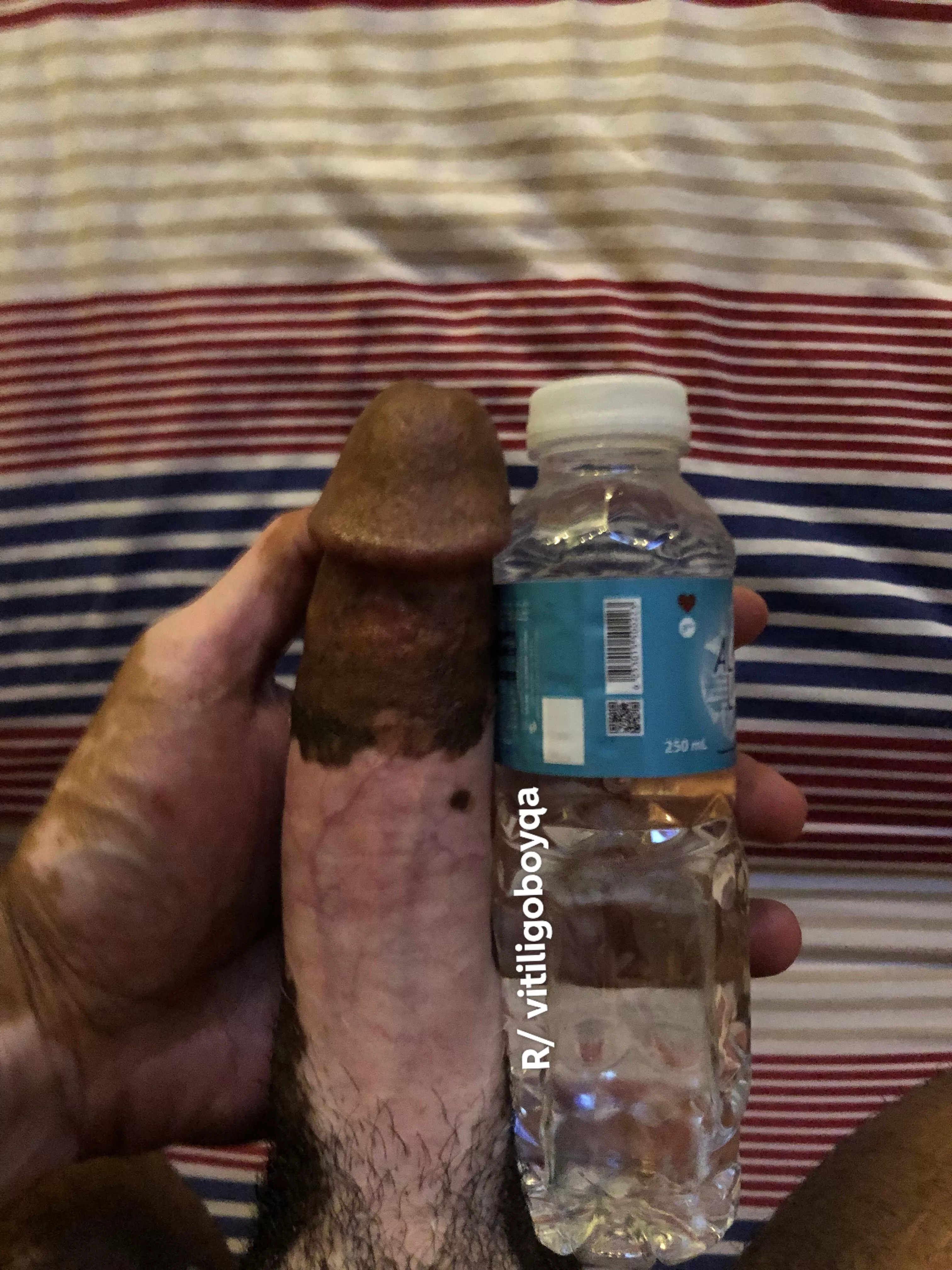 Anyone thirsty? 💦💦 posted by vitiligoboyqa