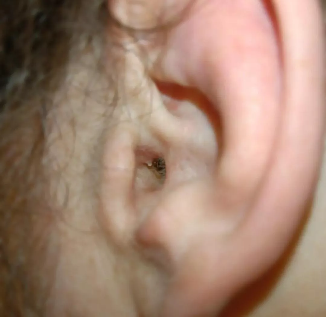 I've been an avid popper my whole life. posted by theCelticTig3r