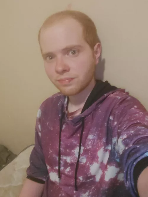 I'm starting to lose my hair and have been really self conscious lately. Hopefully this photo isn't too bad. by jstrait16