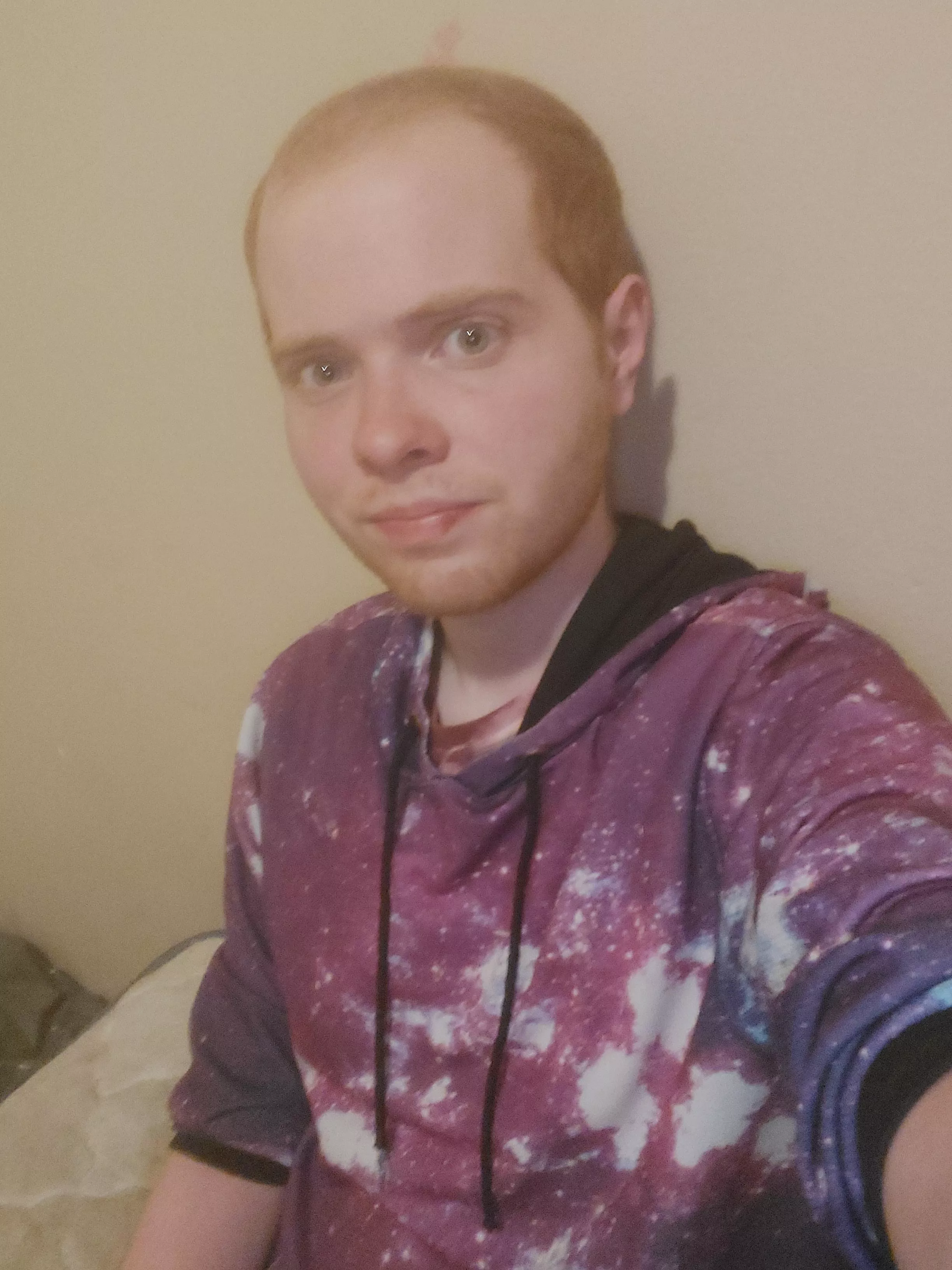 I'm starting to lose my hair and have been really self conscious lately. Hopefully this photo isn't too bad. posted by jstrait16