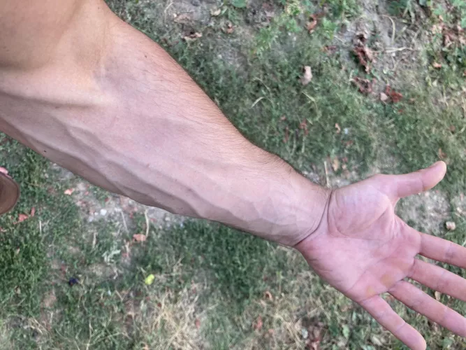 Someone said my hands are rejecting due to my calluses , are they right ? by Prestigious-Army9473