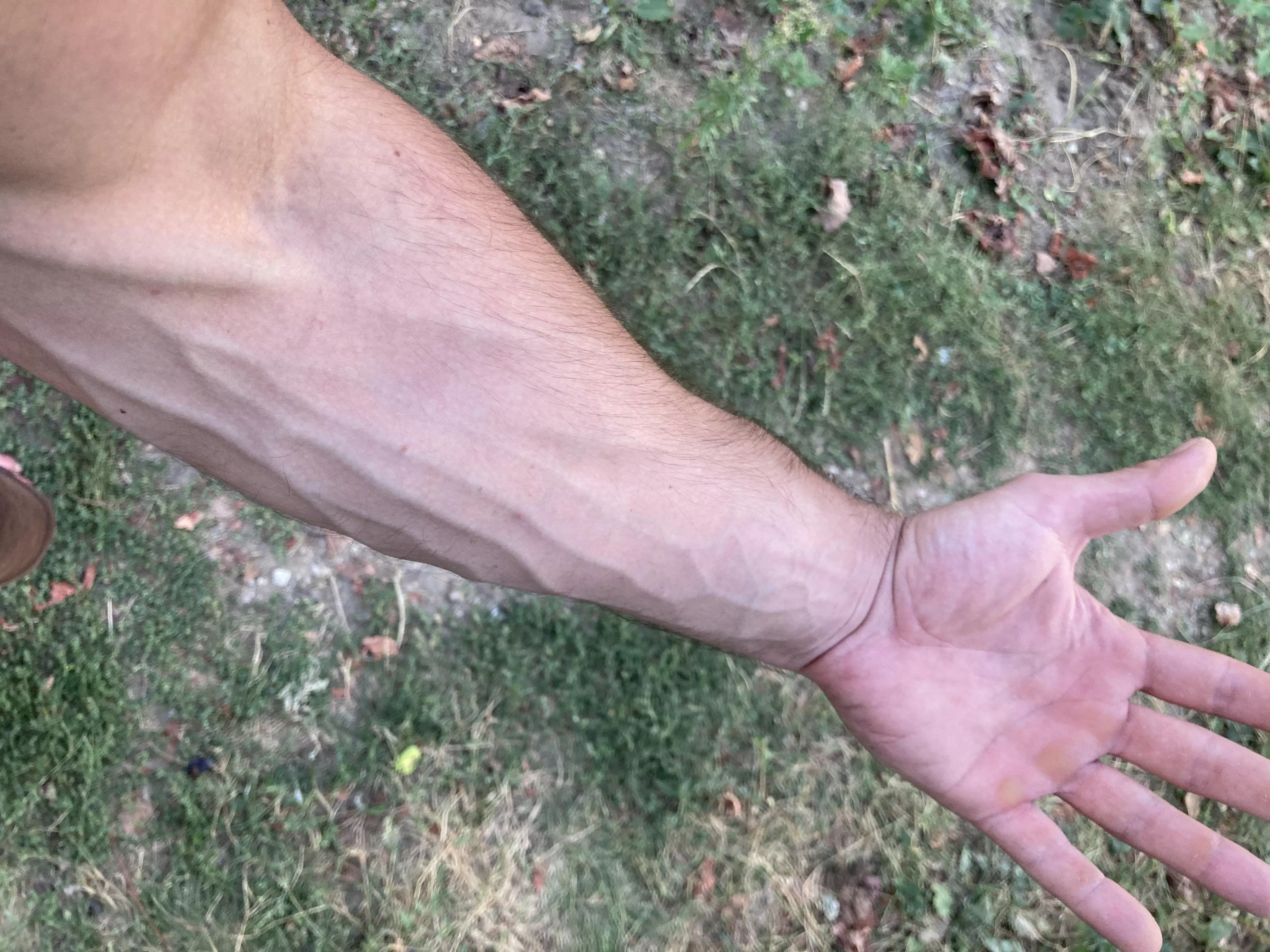 Someone said my hands are rejecting due to my calluses , are they right ? posted by Prestigious-Army9473