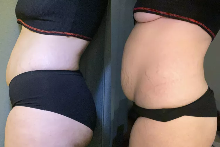 Accidentally devoured 3 big burritos 🌯 by ChunkiKitty