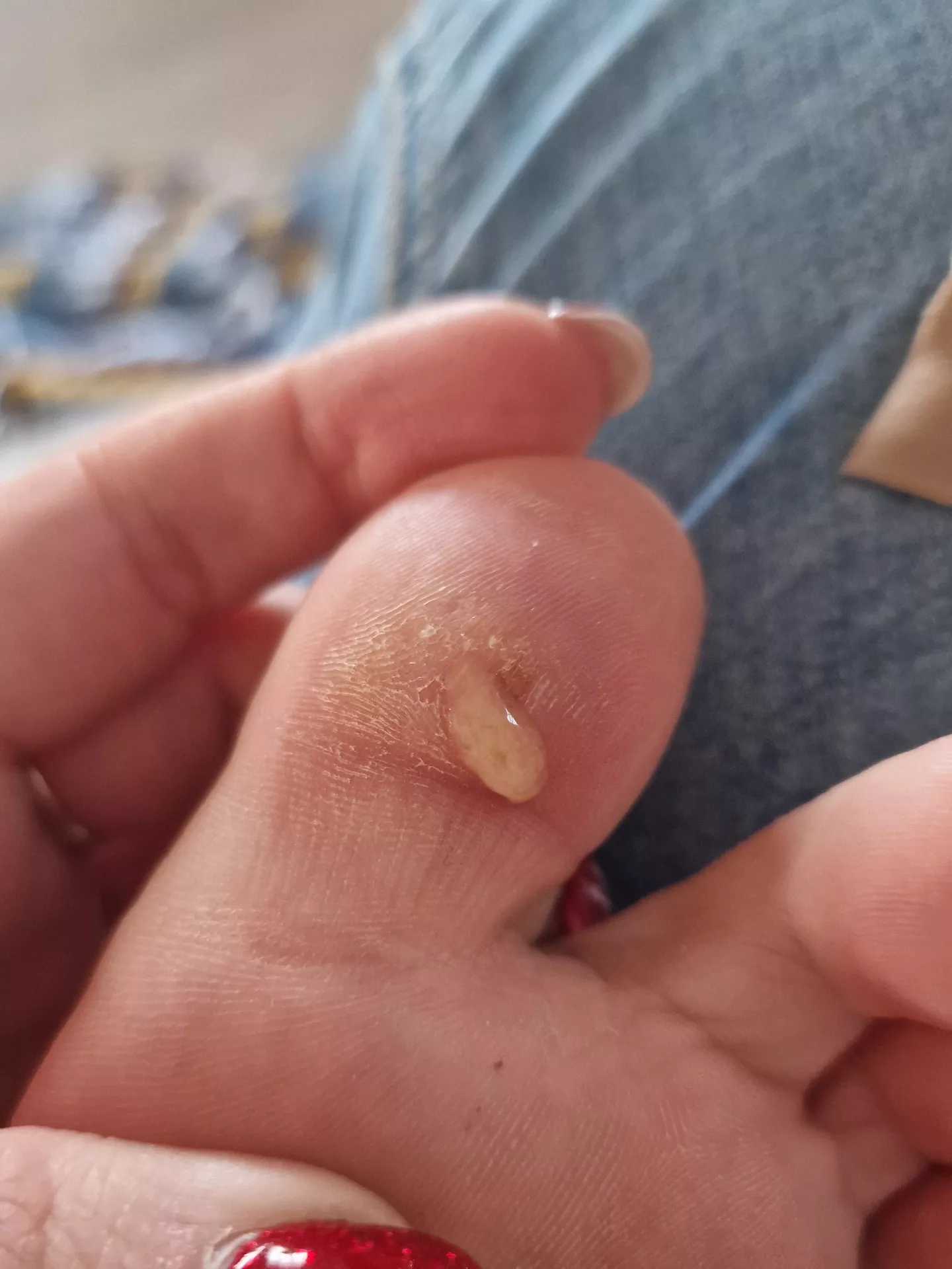 Oh dear it got infected. (Yes I promise I'll film it next time) posted by TopOfThePops2