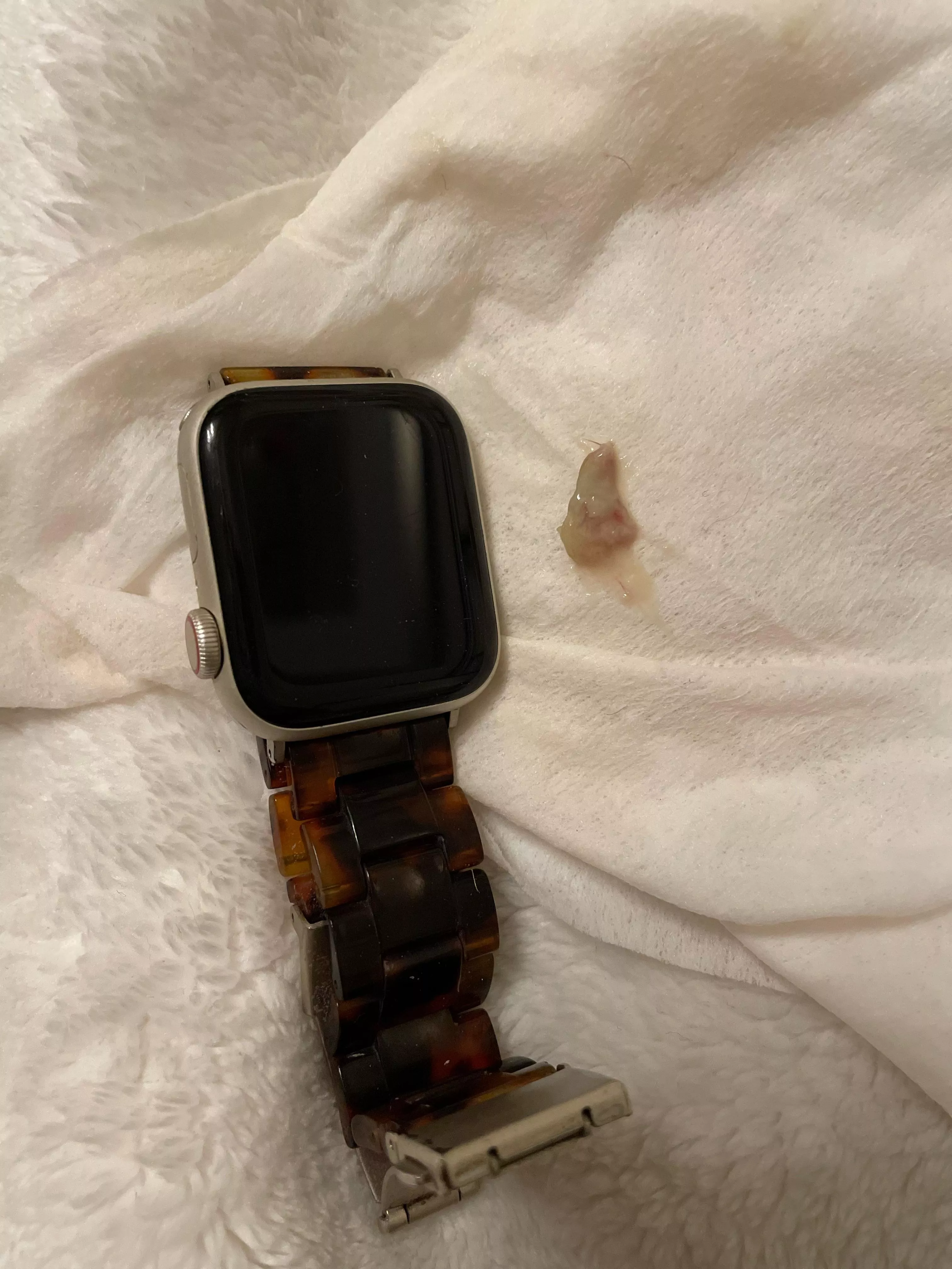 Sinus pop- Apple watch for scale posted by momthom427
