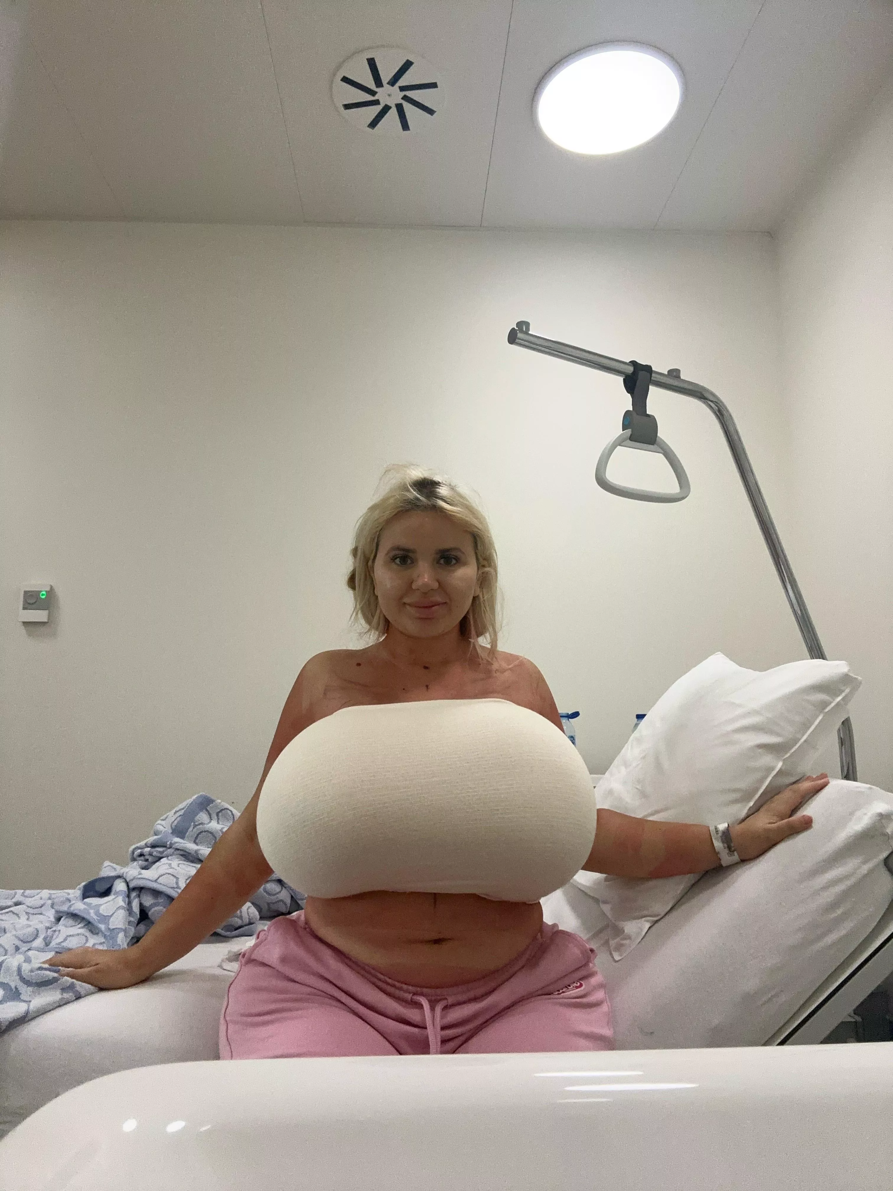 Upgraded to 3750cc today! Haven’t allowed to take the bandage off yet, but I am super exited to see them! posted by Jessy_Bunny