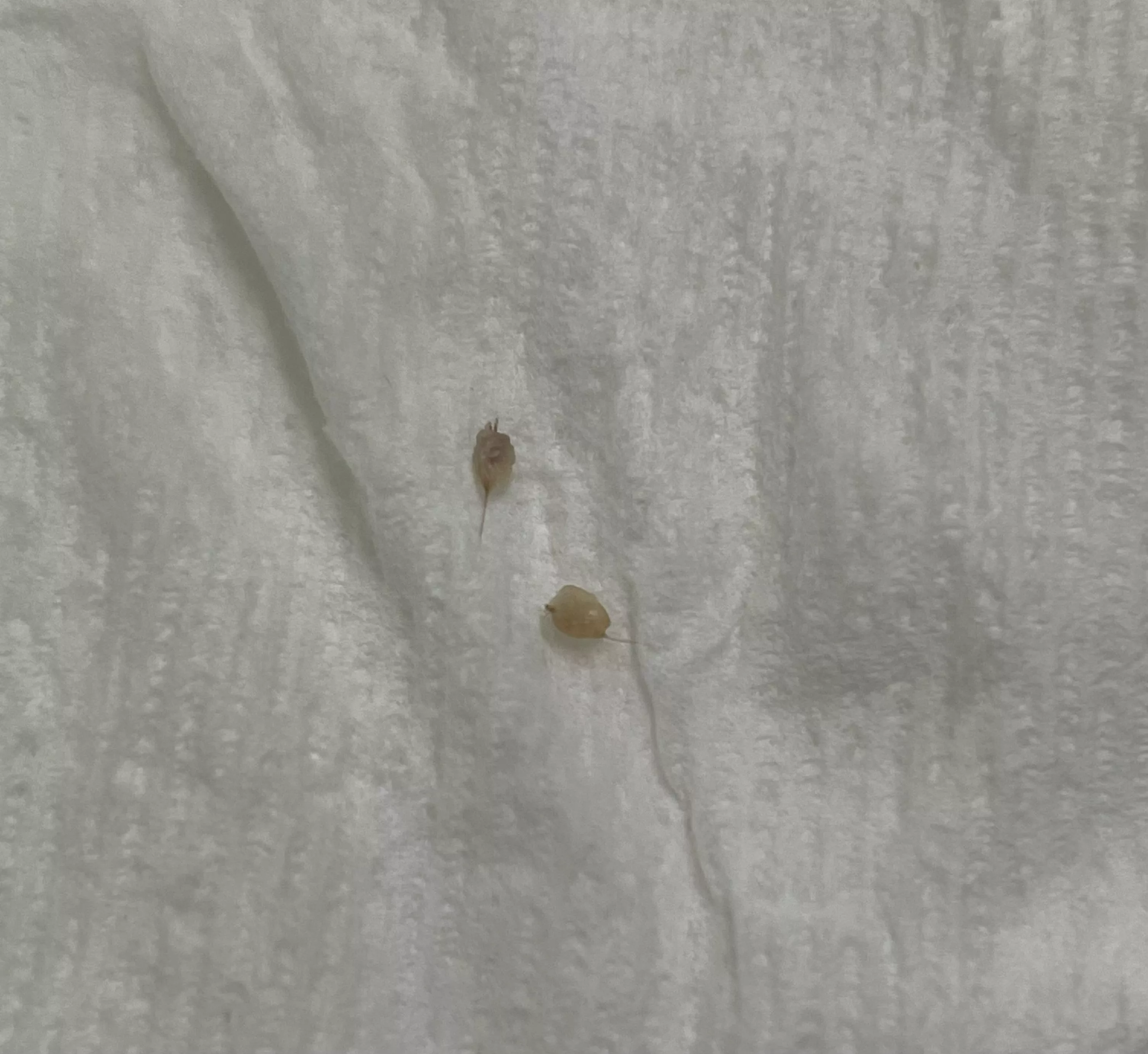 After 4 months of having these two painful small bumps on each of my buttcheeks, I am free posted by Round-Huckleberry-88